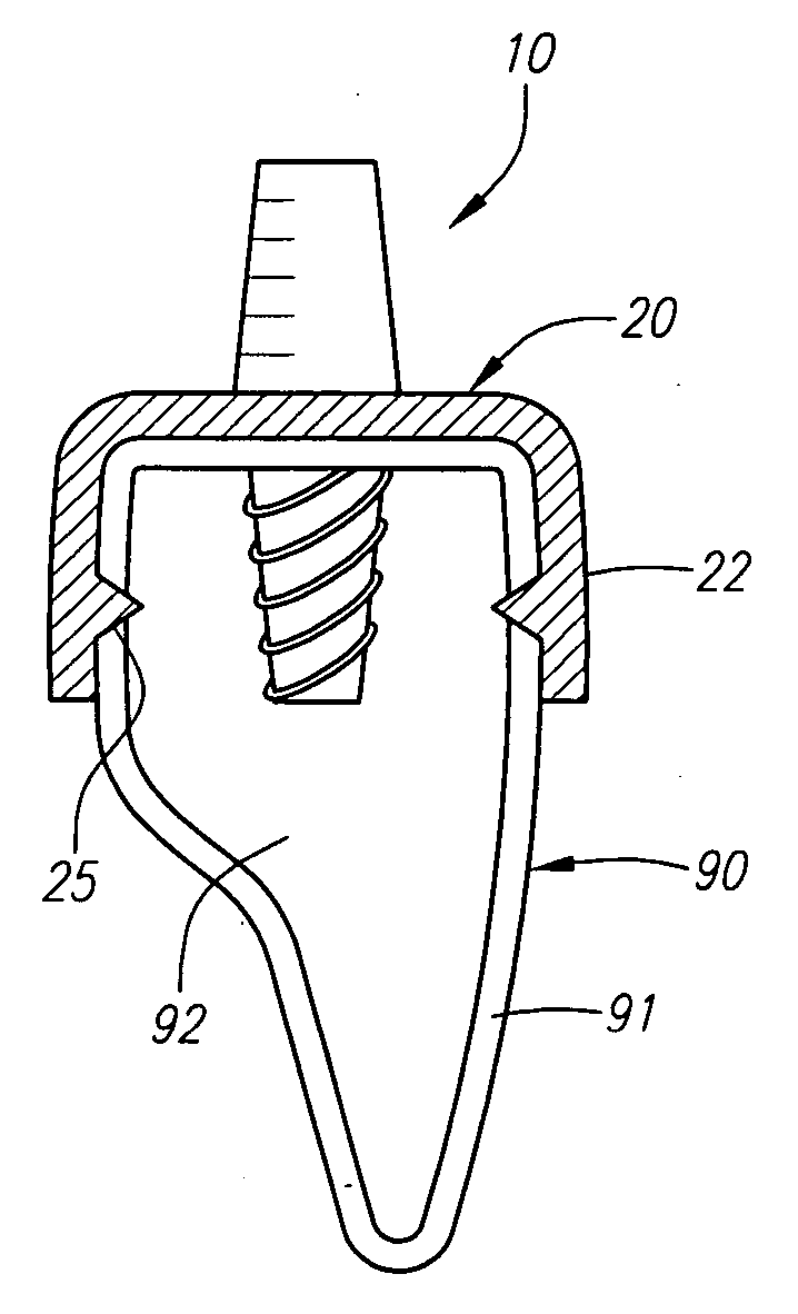 Dental implants with improved loading properties