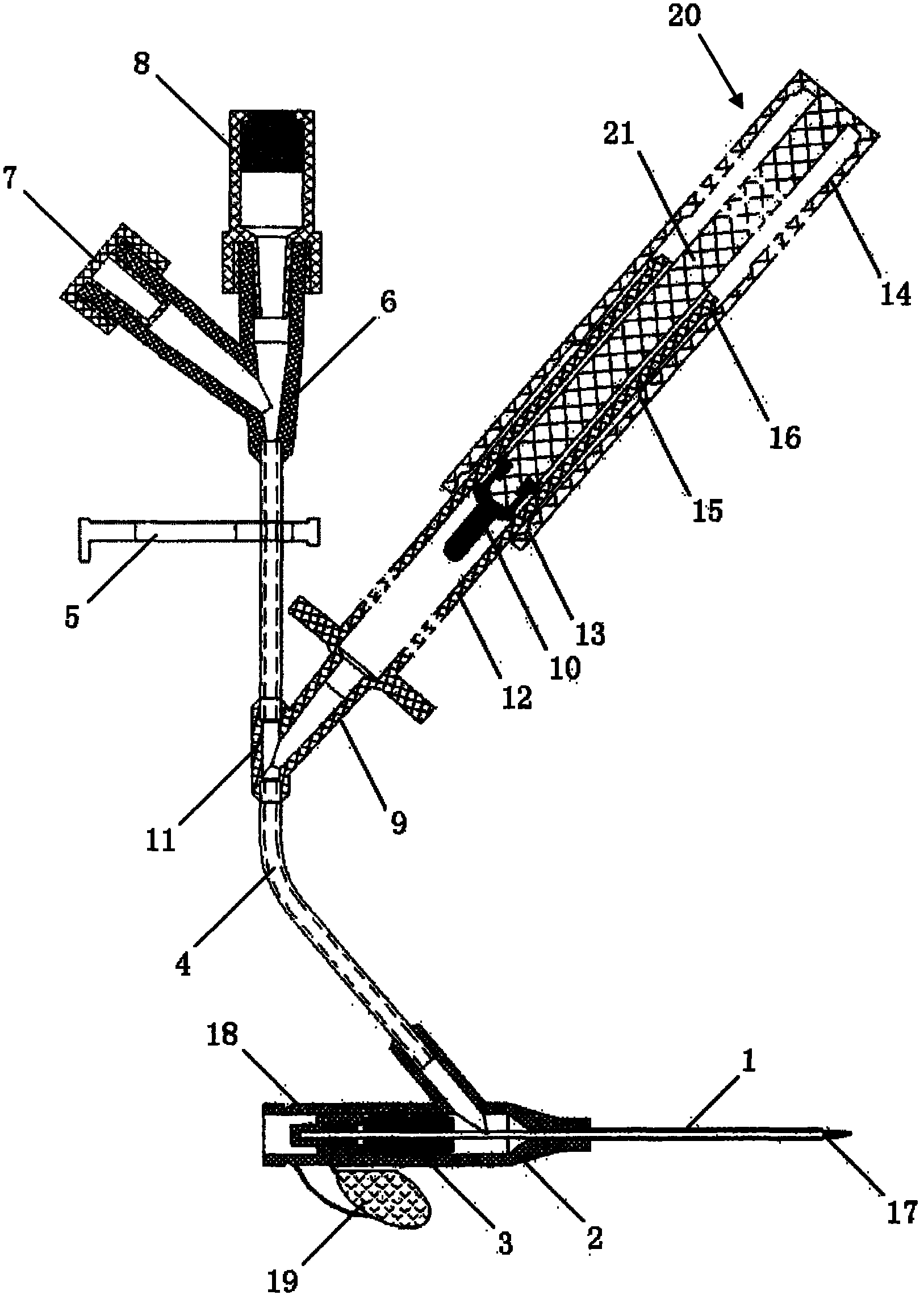 Hirudin anticoagulation tube sealing device for venous retention needle