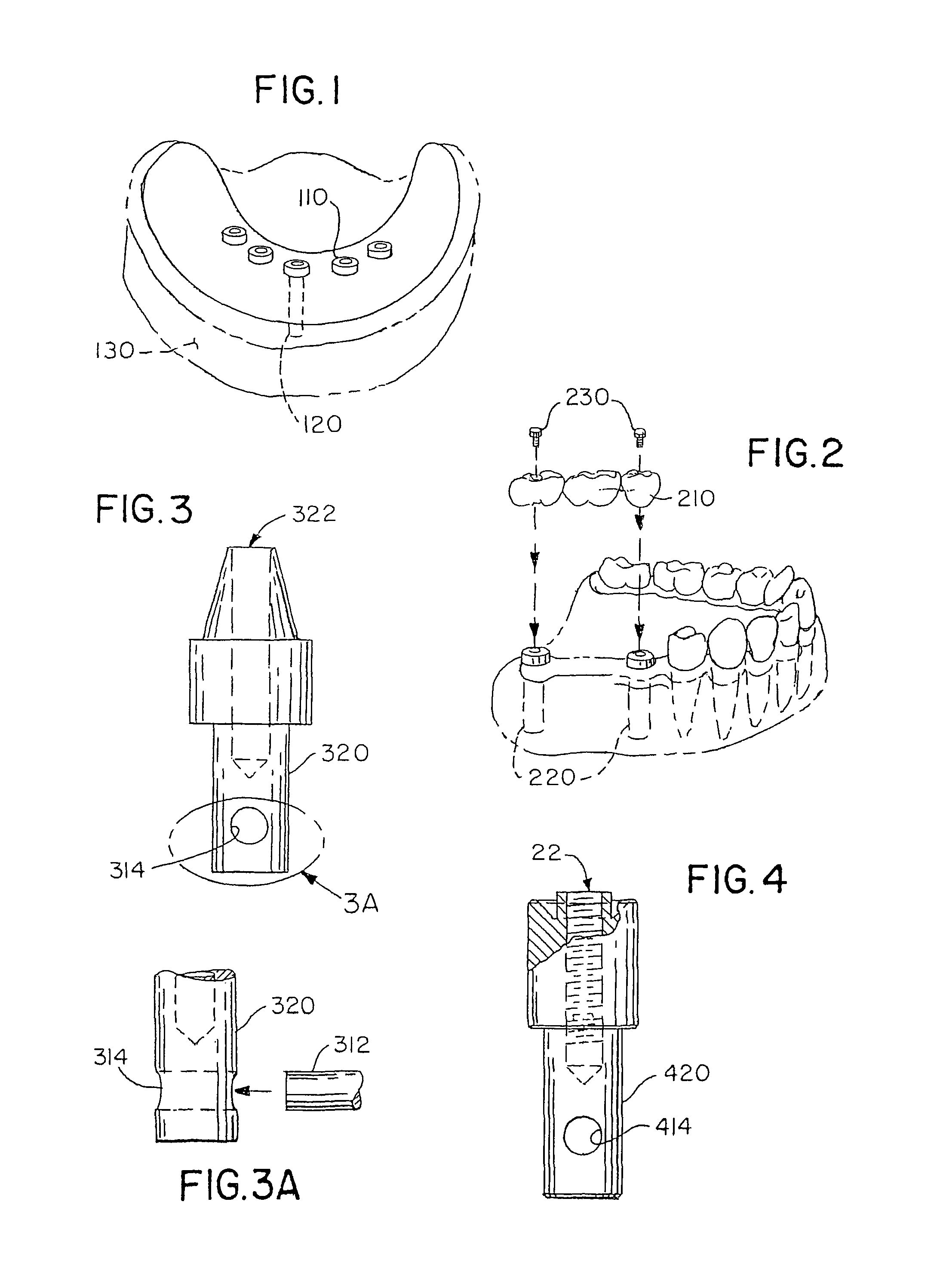 Accurate analogs for bone graft prostheses using computer generated anatomical models