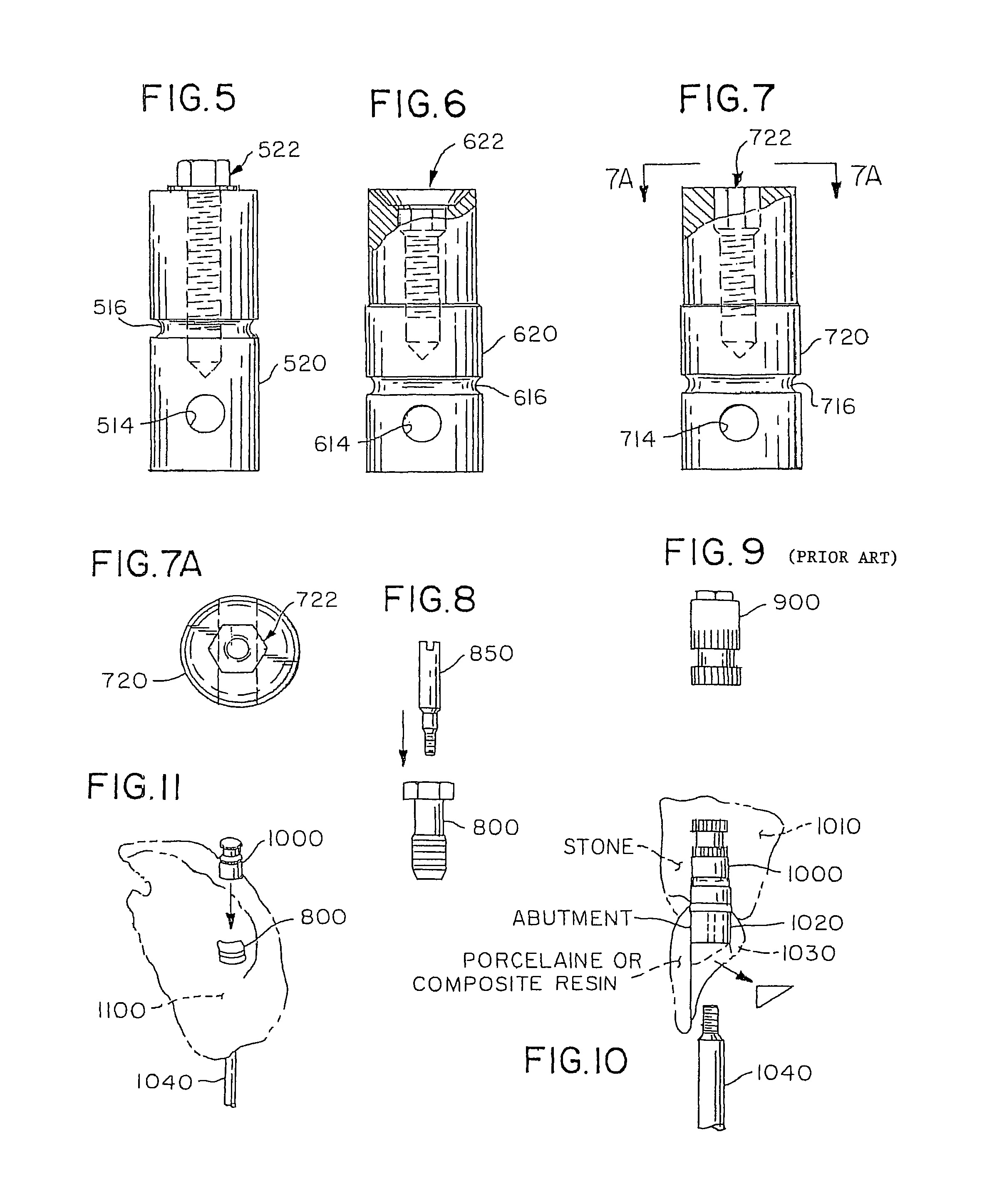 Accurate analogs for bone graft prostheses using computer generated anatomical models