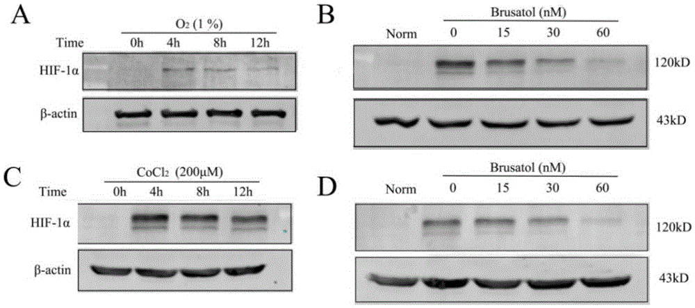 Use of brusatol in preparation of drugs for resisting tumor angiogenesis