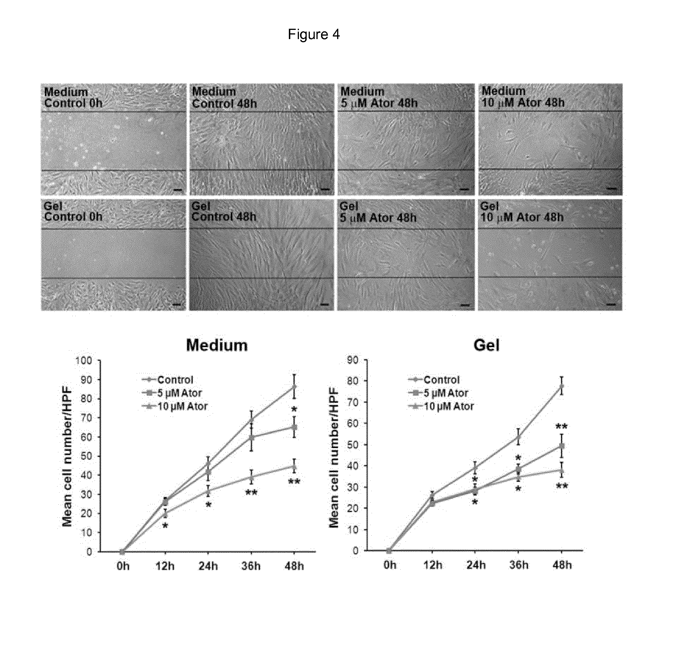 Pharmaceutical formulation for use in the treatment and/or prevention of restenosis