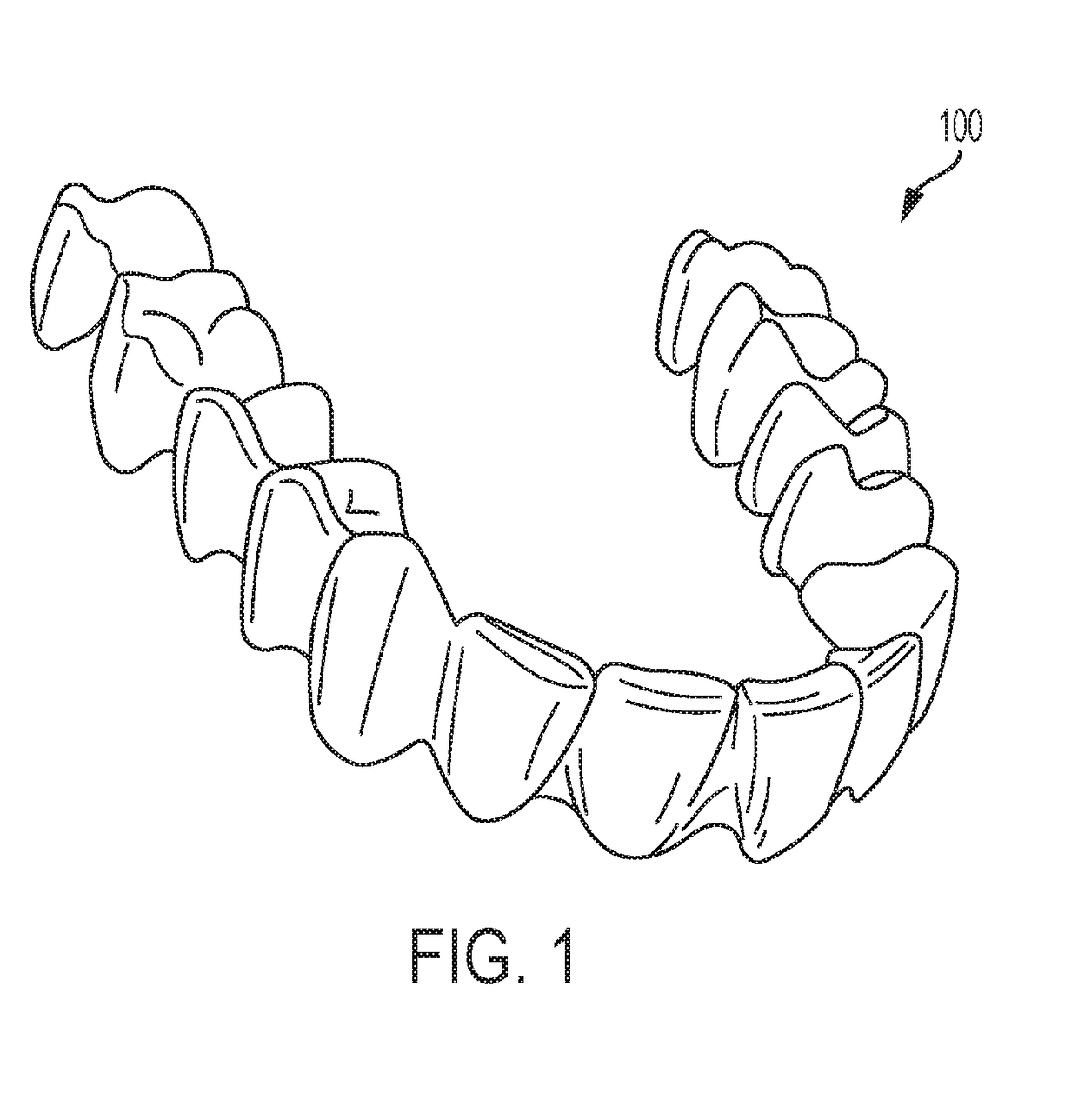 Orthodontic Lip Advancer