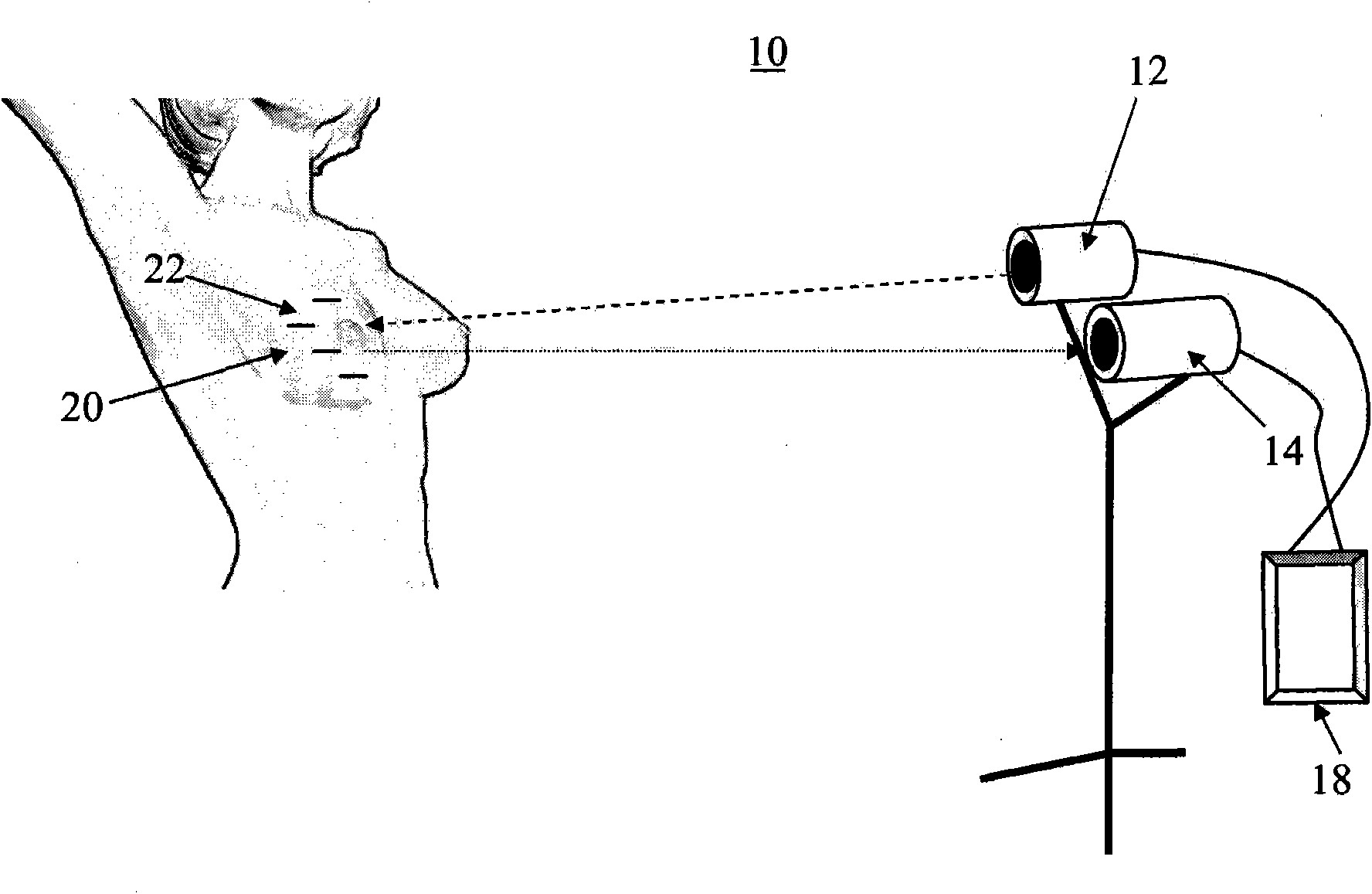 System and method for registration of imaging data