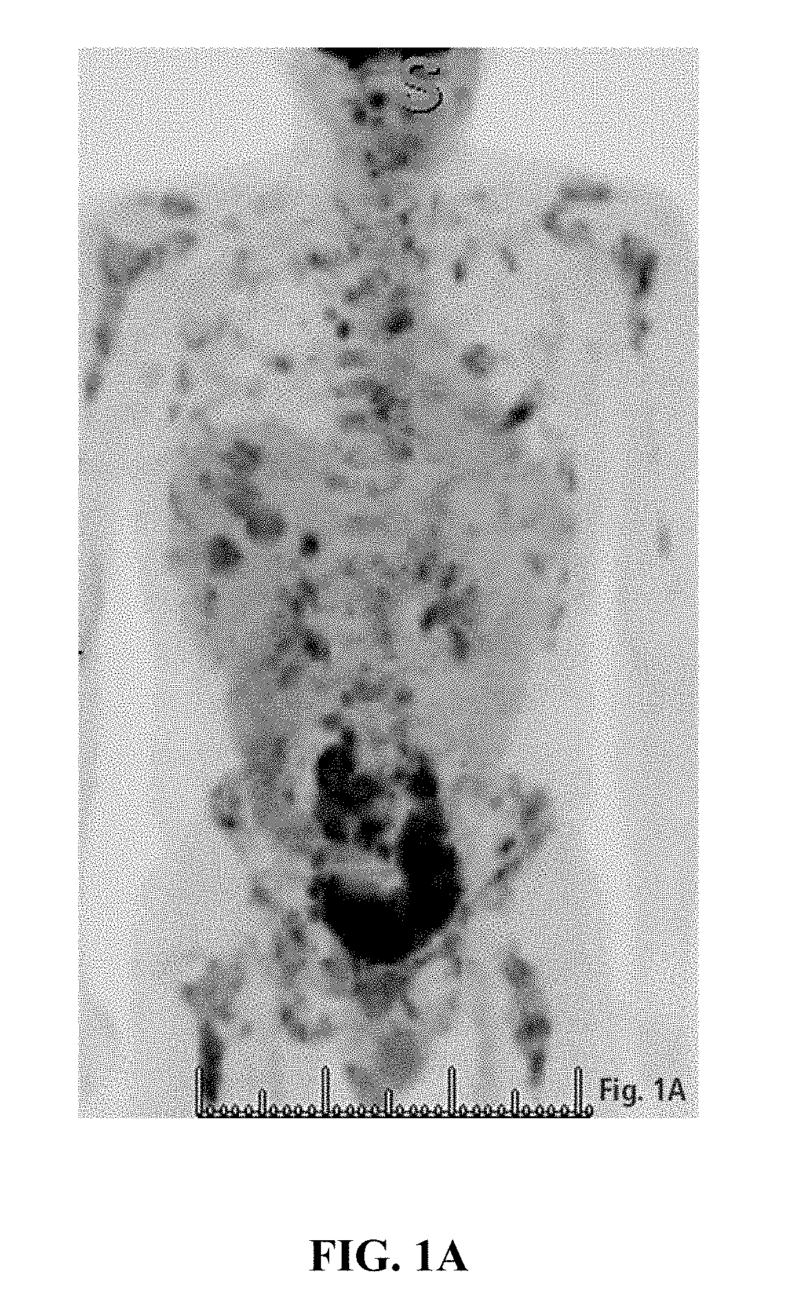 Methods of treating a neuroendocrine tumor