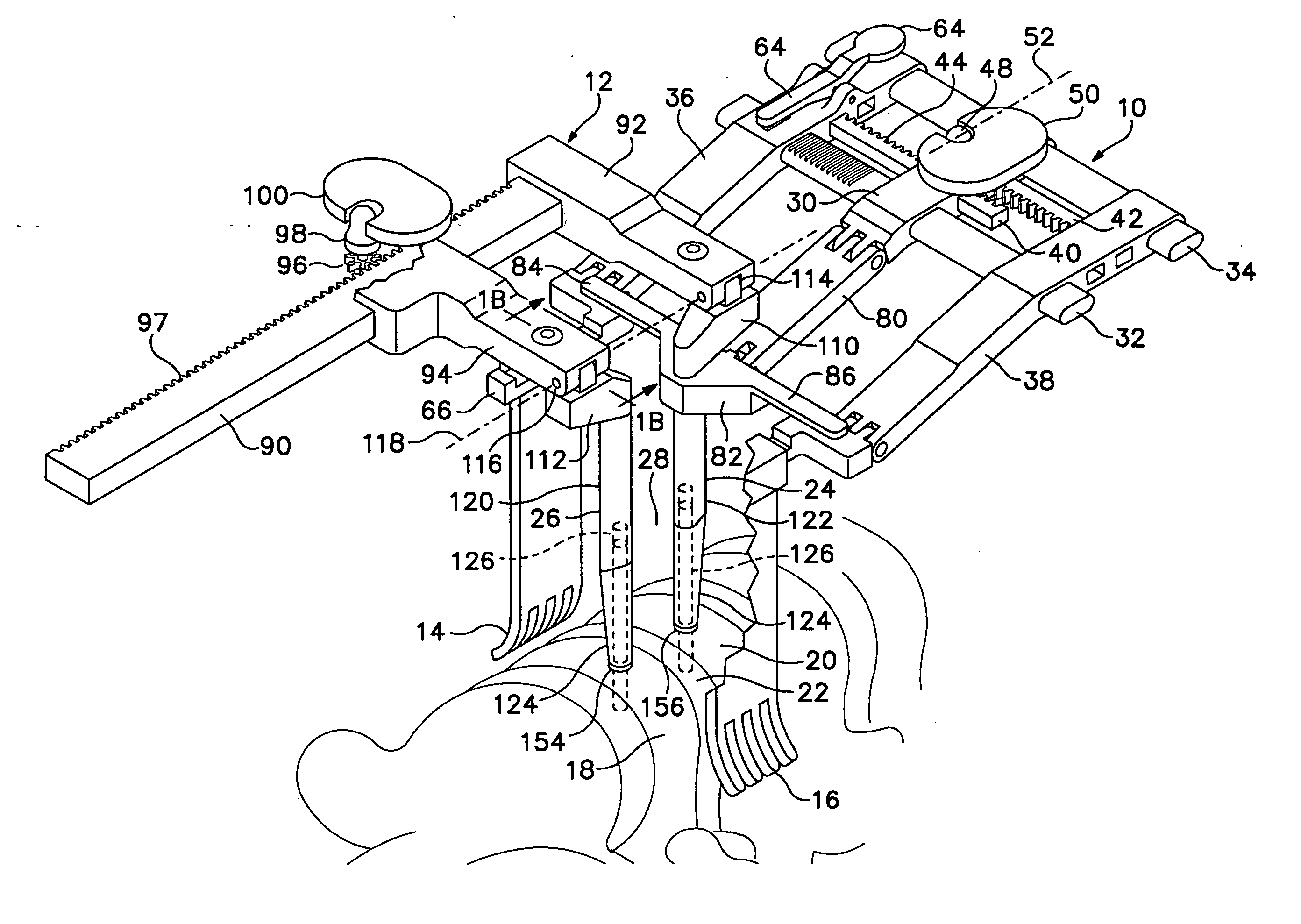 Retractor and distractor system for use in anterior cervical disc surgery