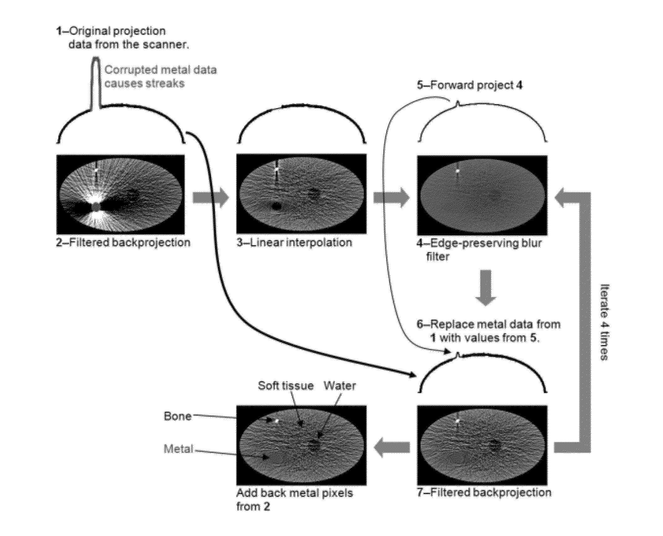 Iterative reduction of artifacts in computed tomography images using forward projection and an edge-preserving blur filter