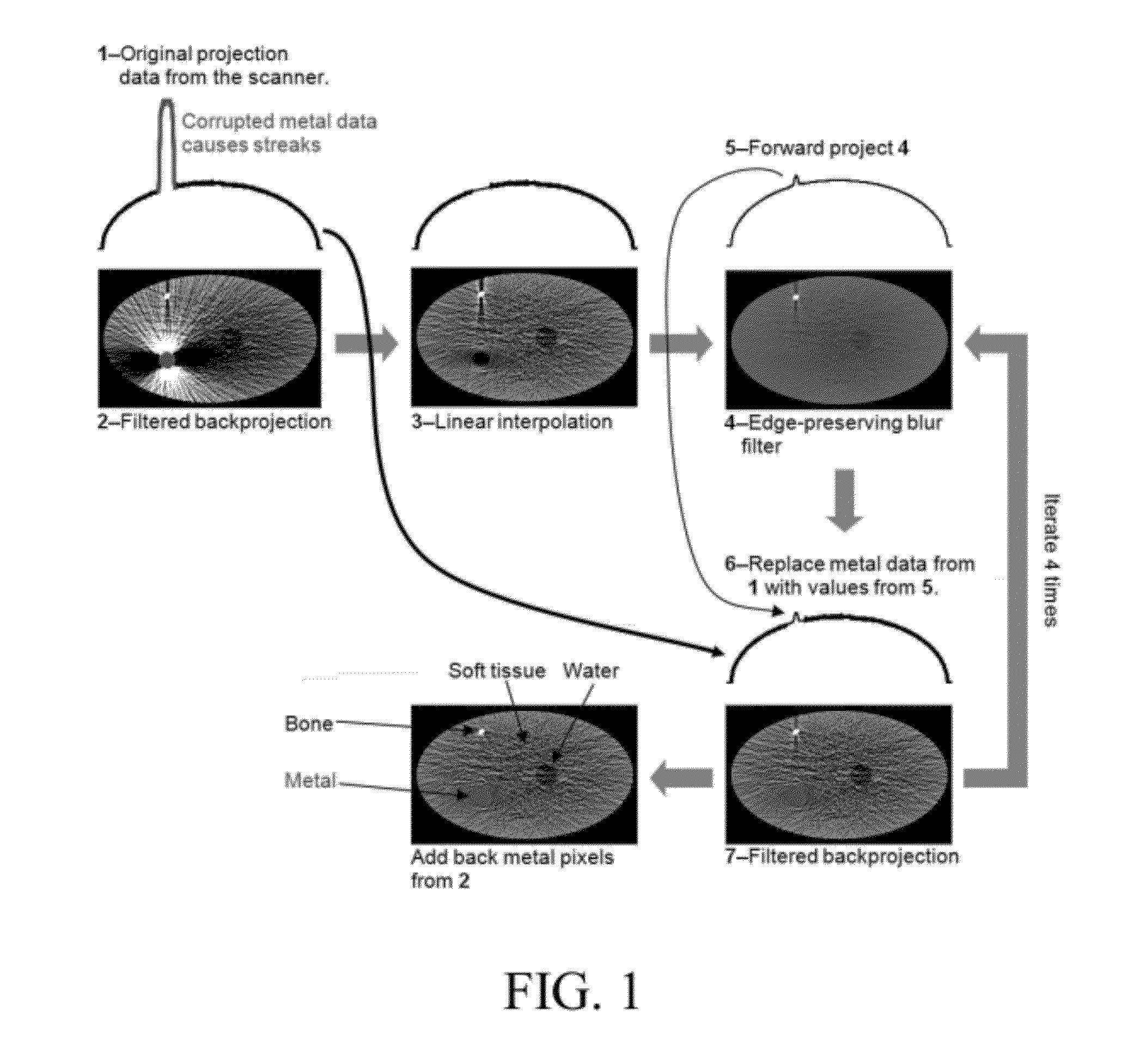 Iterative reduction of artifacts in computed tomography images using forward projection and an edge-preserving blur filter