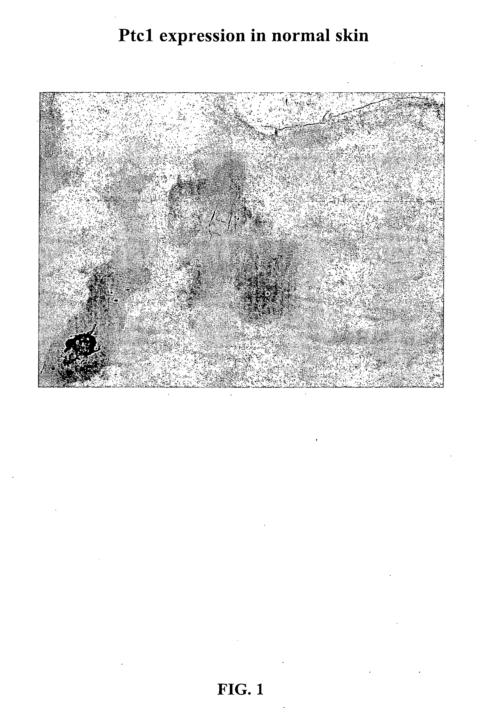 Morphogen compositions and use thereof to treat wounds