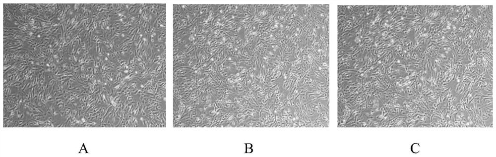 Serum-free medium for mesenchymal stem cells (MSCs) and preparation method of serum-free medium