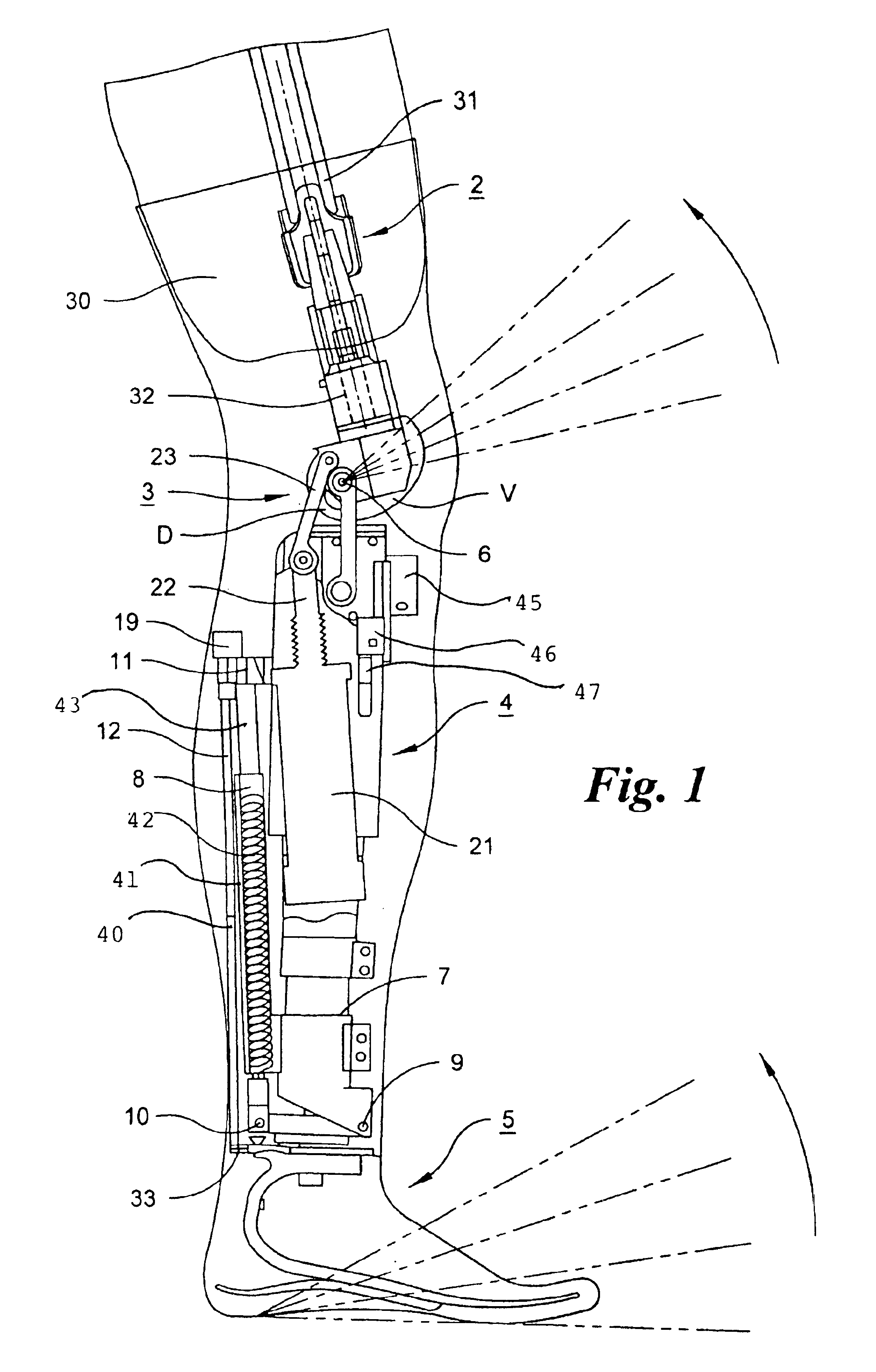 Leg prosthesis