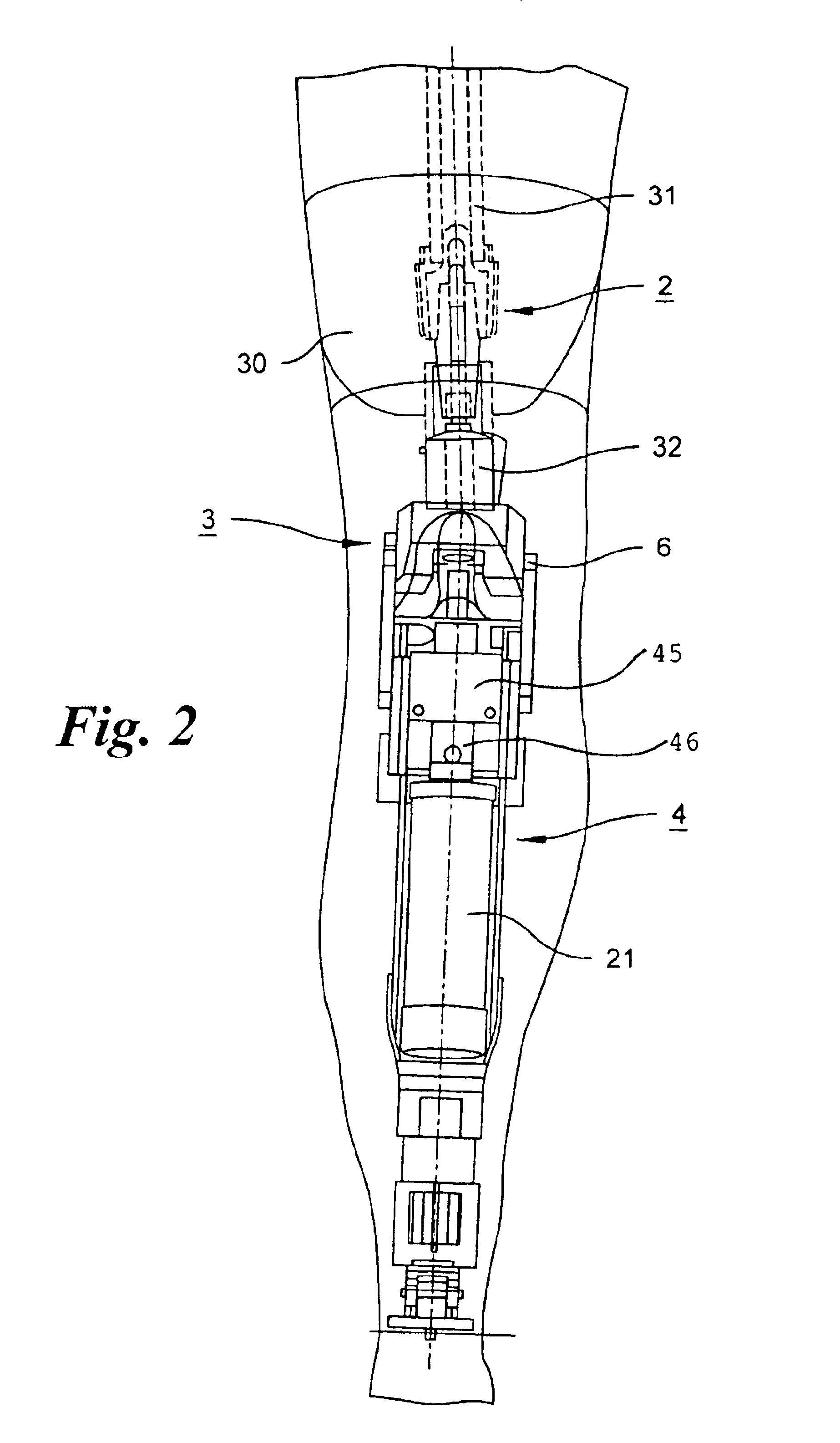 Leg prosthesis