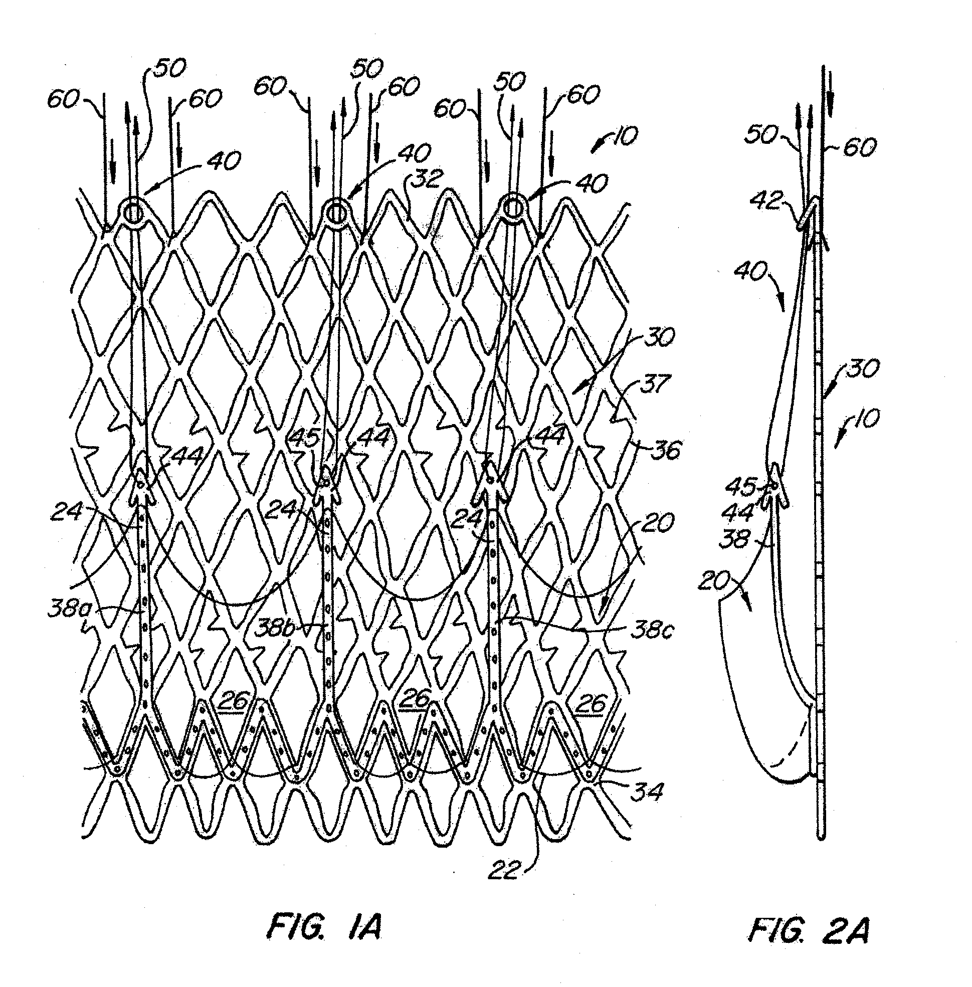 Everting Heart Valve