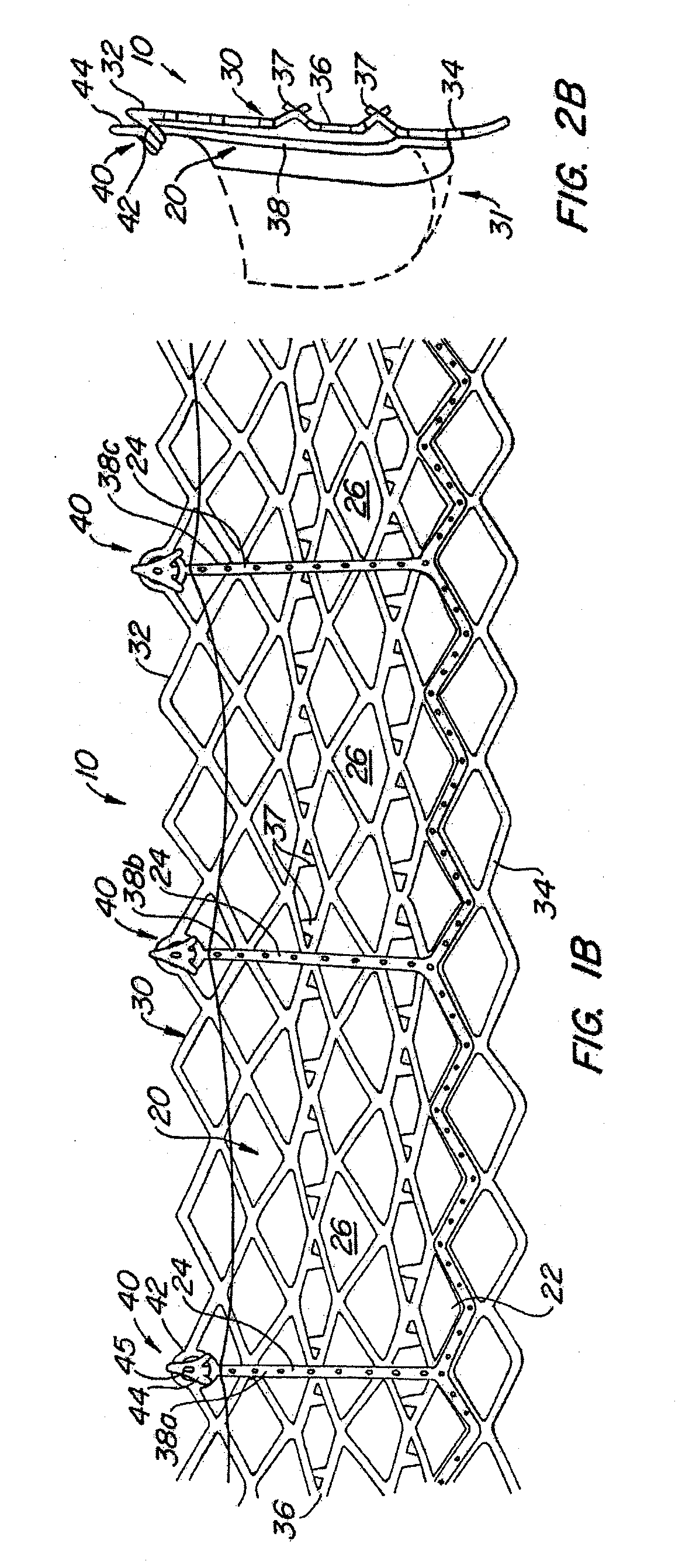 Everting Heart Valve