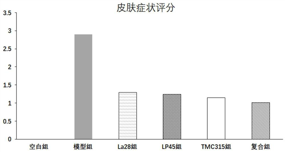 Application of Bifidobacterium bifidum tmc3115 and its complex bacteria in alleviating and improving allergy
