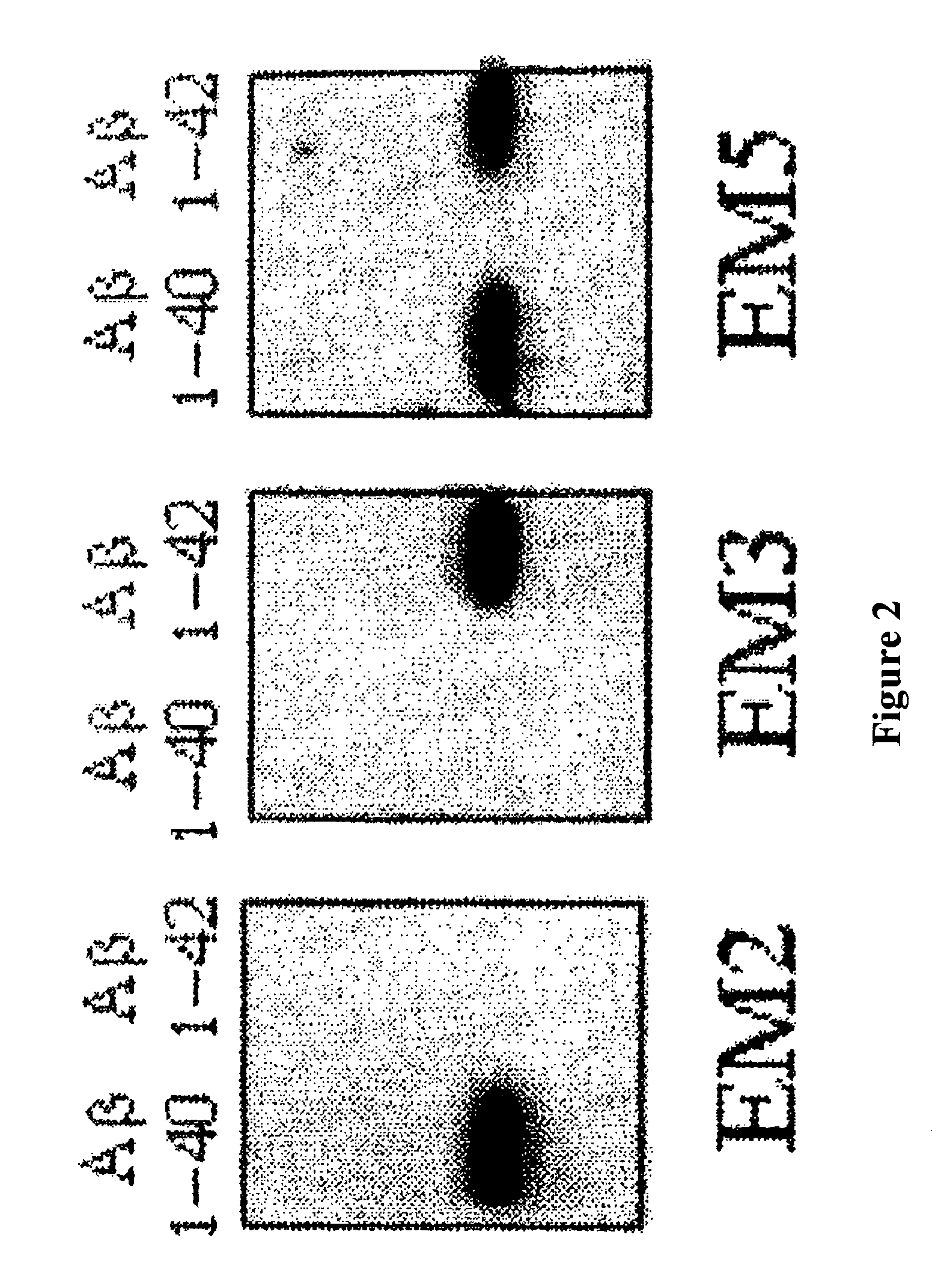 Method for the in vitro diagnosis of alzheimer's disease using a monoclonal antibody