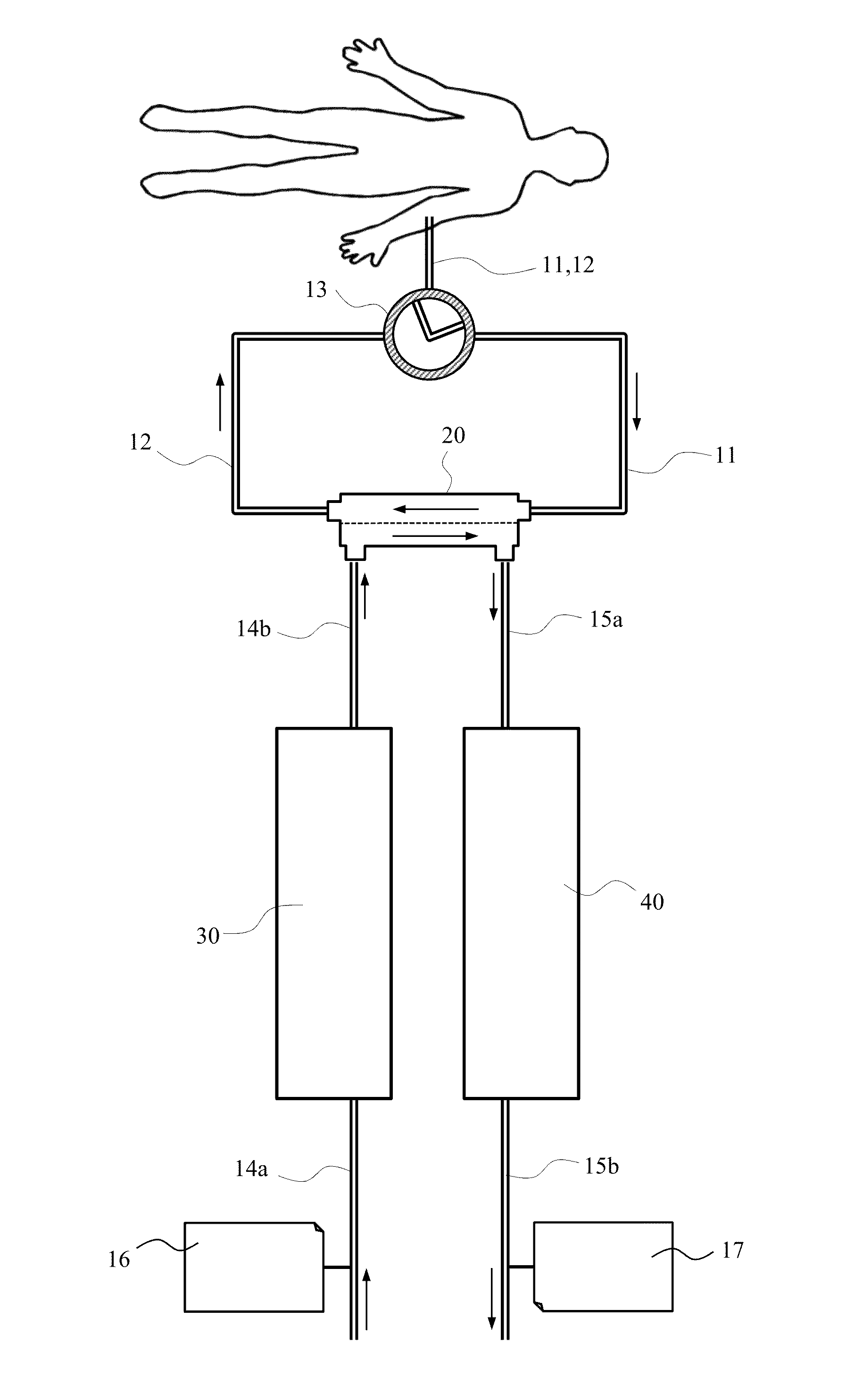 Hemodialysis apparatus