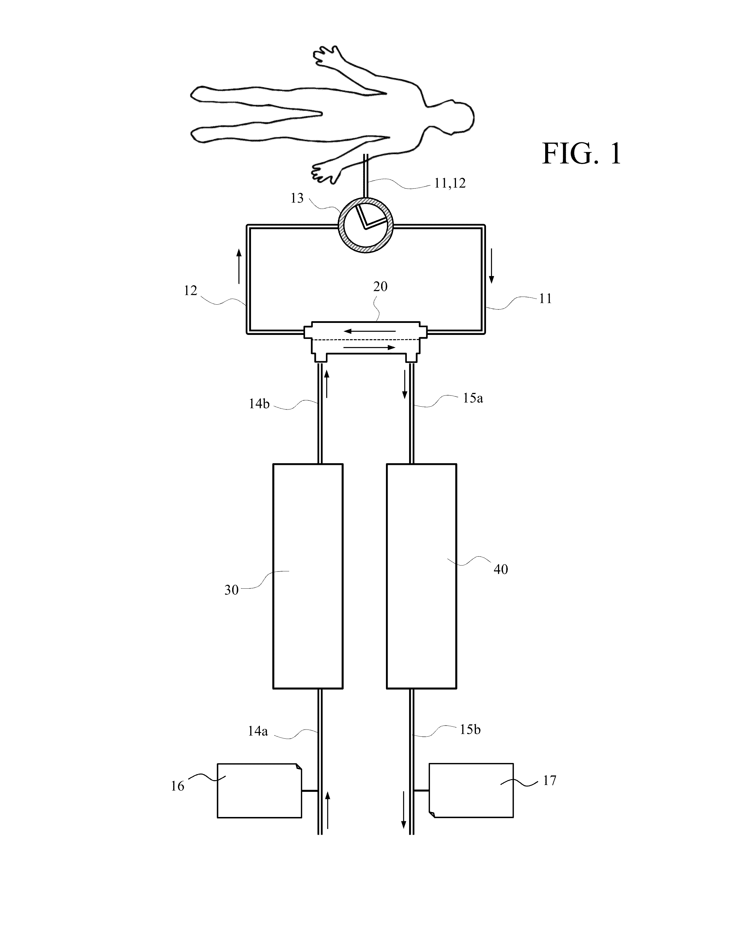 Hemodialysis apparatus