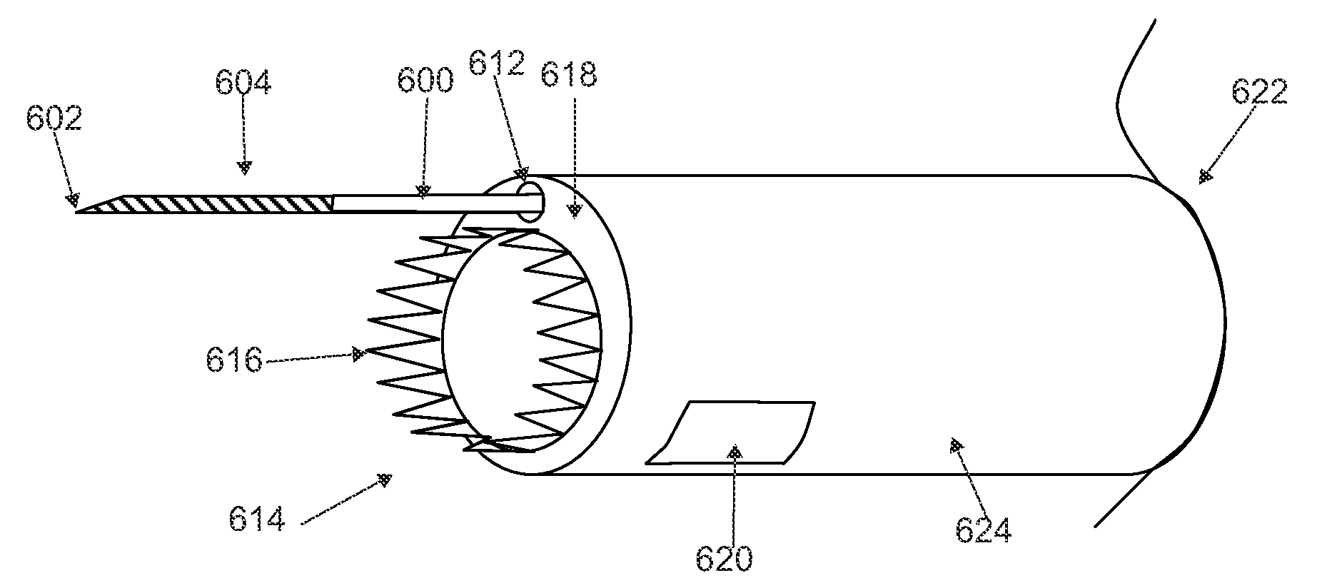 Method and devices for treating spinal stenosis