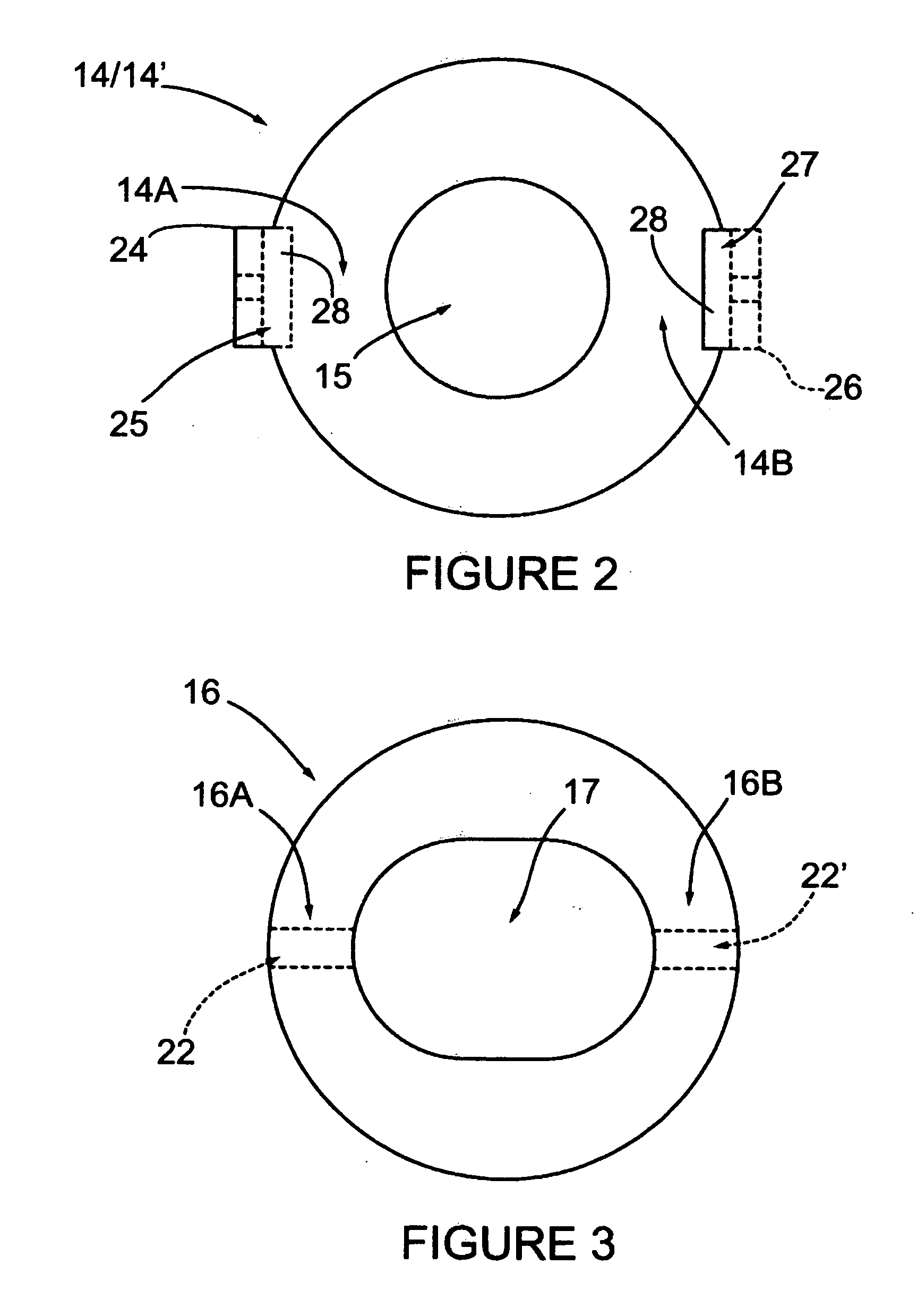 Locking wedge system