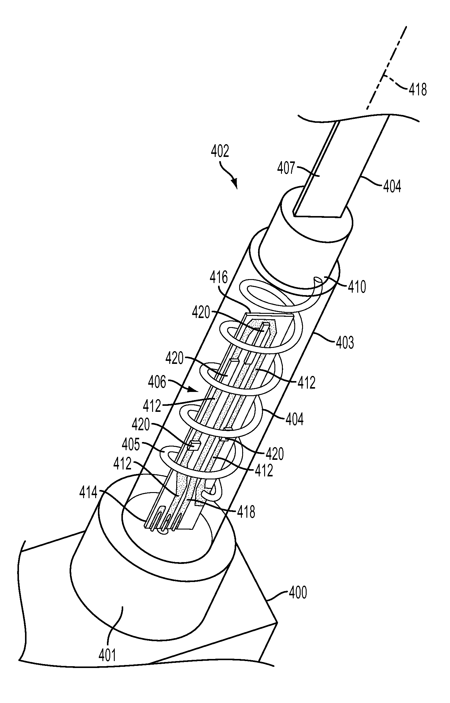 Orthogonal feed technique to recover spatial volume used for antenna matching