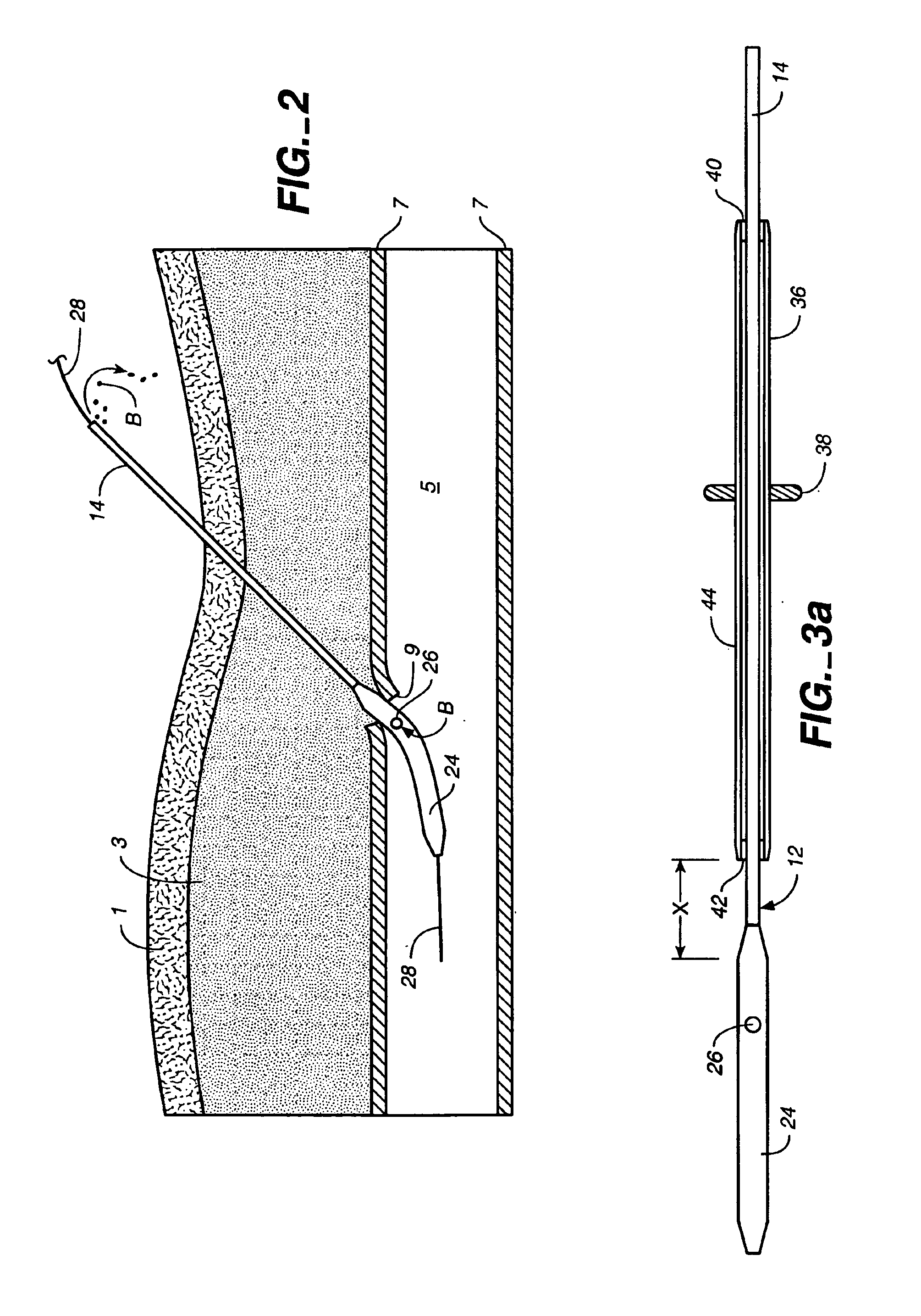 Depth and puncture control for blood vessel hemostasis system