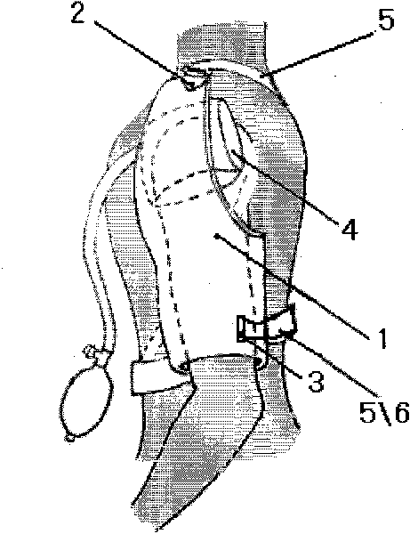 Single-shoulder adjustable clavicle fracture external fixator