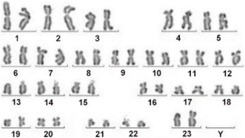 Human normal corneal epithelium cells and application thereof