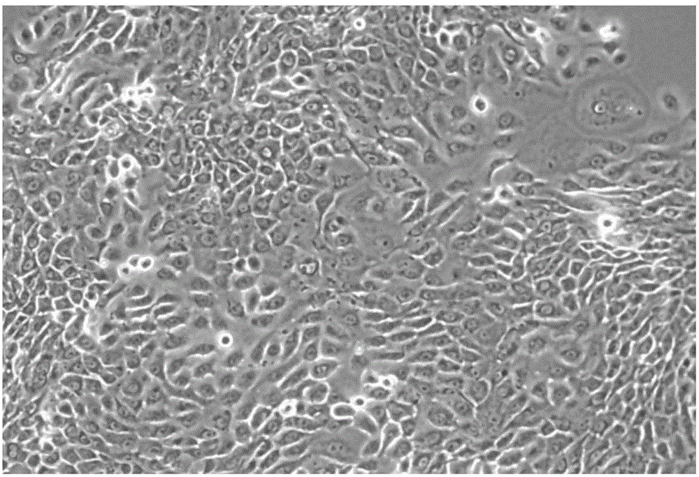 Human normal corneal epithelium cells and application thereof