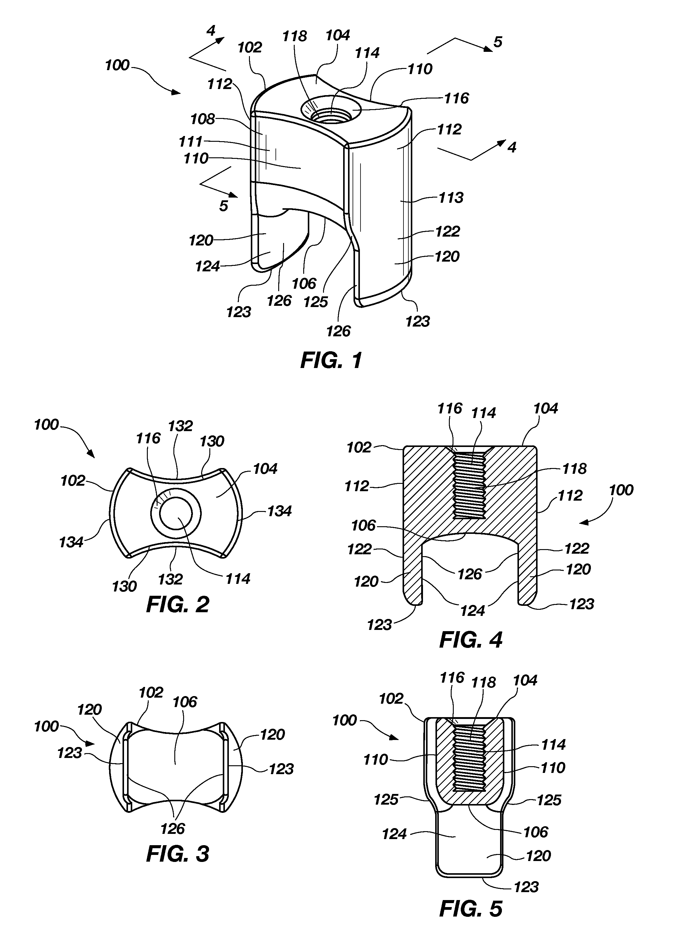 Tenodesis fixation method