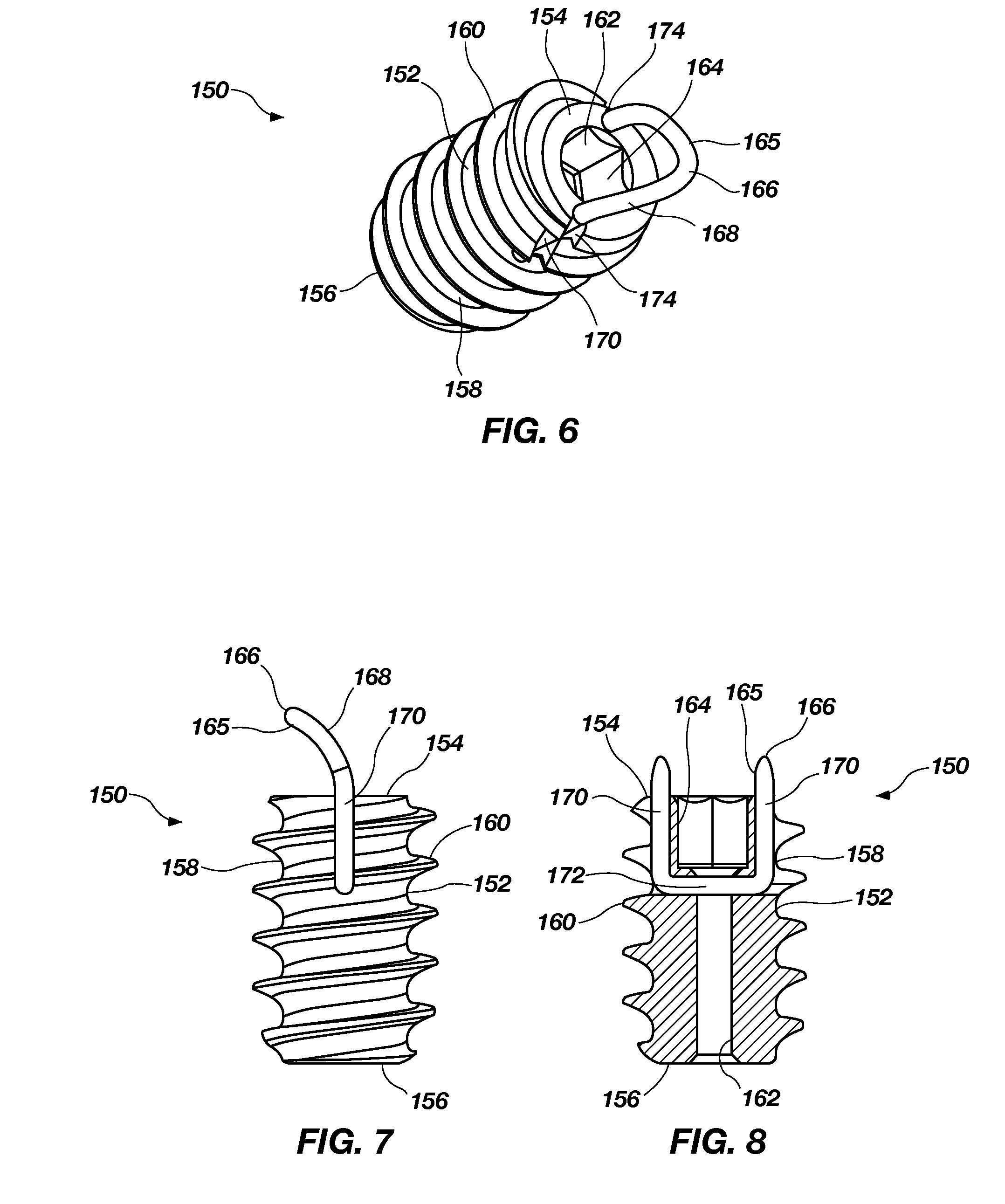 Tenodesis fixation method