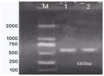 SNP molecular markers, primer pairs and kit of FABP4 gene related to beef quality in Yanbian yellow cattle and application of SNP molecular marker, primer pair and kit