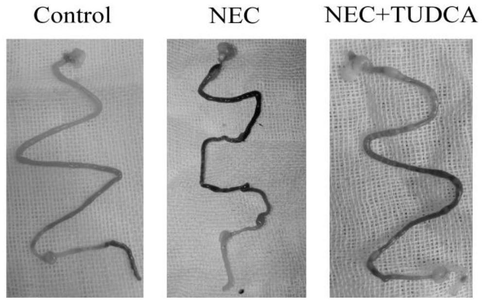 Application of tauroursodeoxycholic acid in treatment of neonatal necrotic enterocolitis