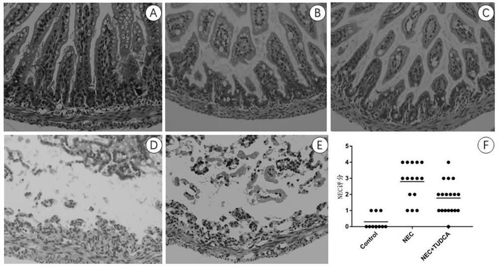 Application of tauroursodeoxycholic acid in treatment of neonatal necrotic enterocolitis