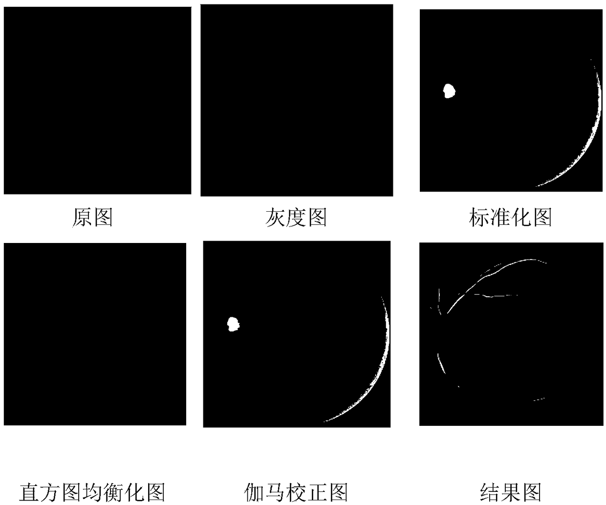 A method and apparatus for blood vessel segmentation of fundus oculi image