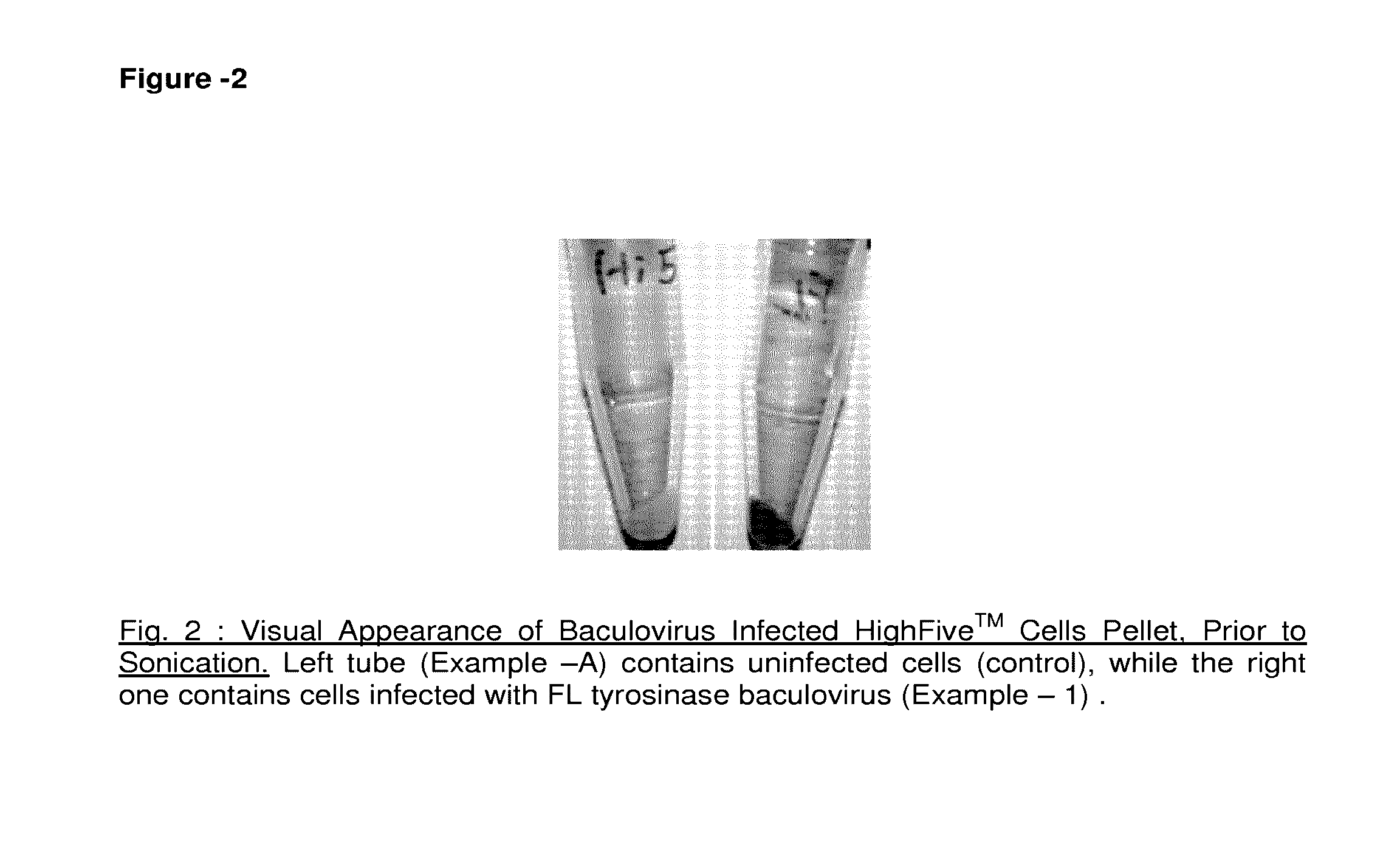 Method of preparing recombinant human tyrosinase