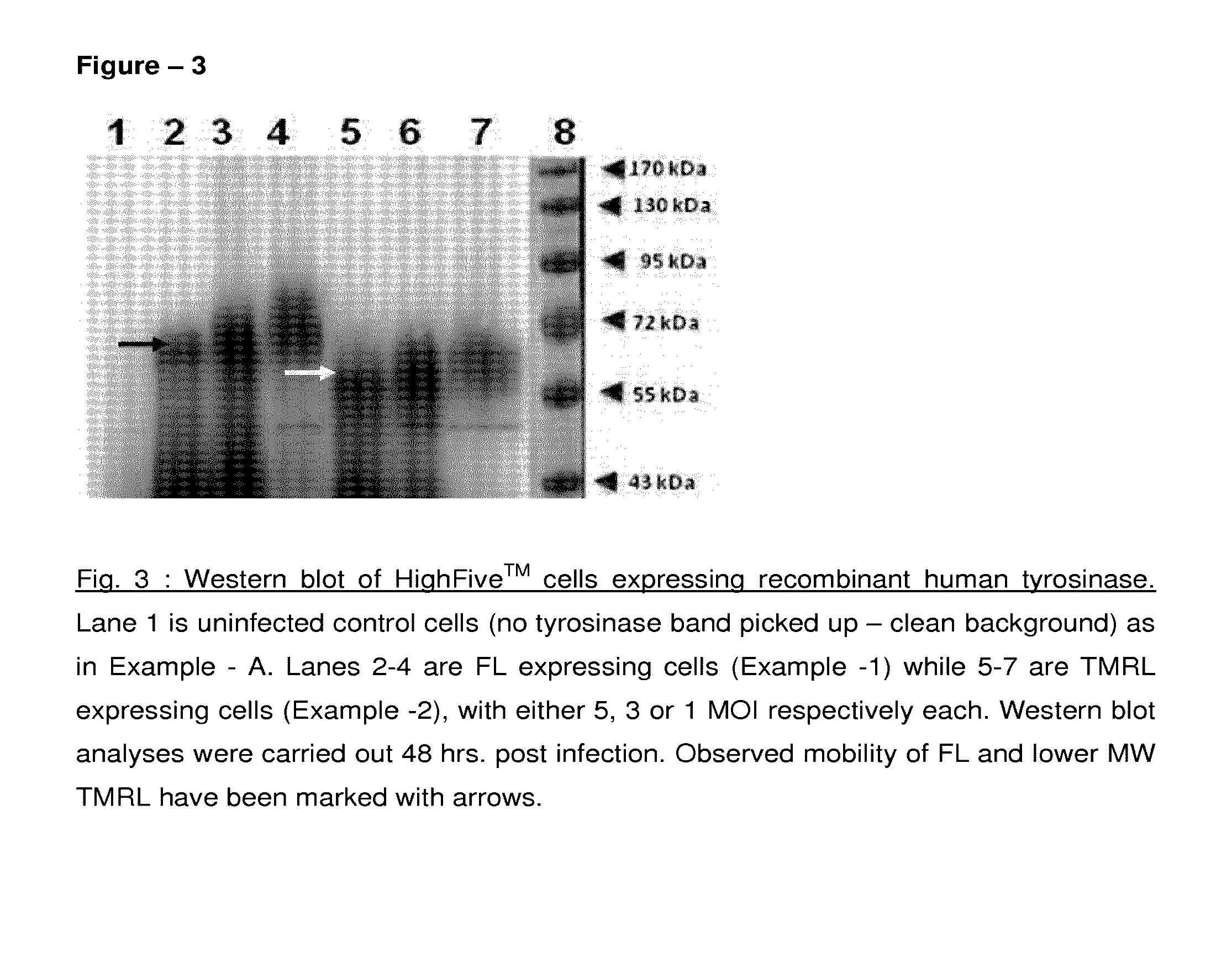 Method of preparing recombinant human tyrosinase