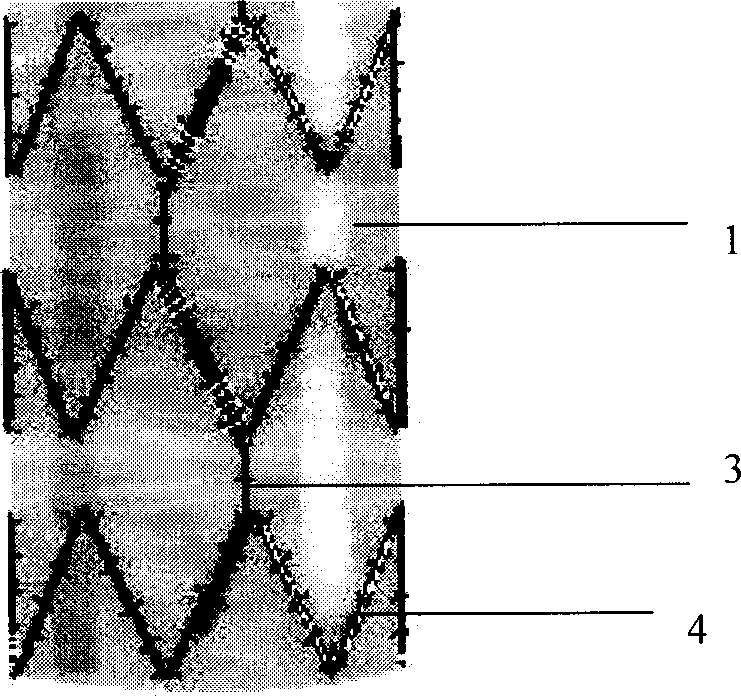 Leg type lower limb artificial vein valve