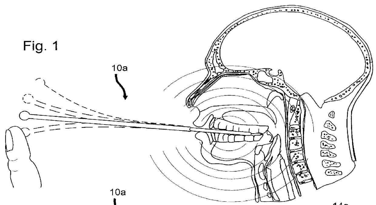 Method and device for treating headaches, sinus congestion and congestion as well as drug withdrawal