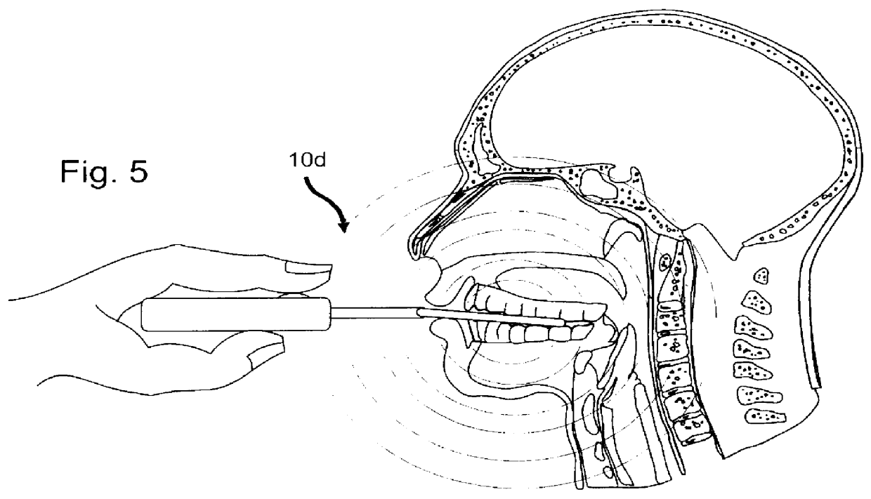 Method and device for treating headaches, sinus congestion and congestion as well as drug withdrawal