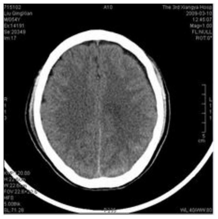 A Real-time Encryption and Decryption Algorithm in Wavelet Domain of Medical Image Based on Multiple Chaos System