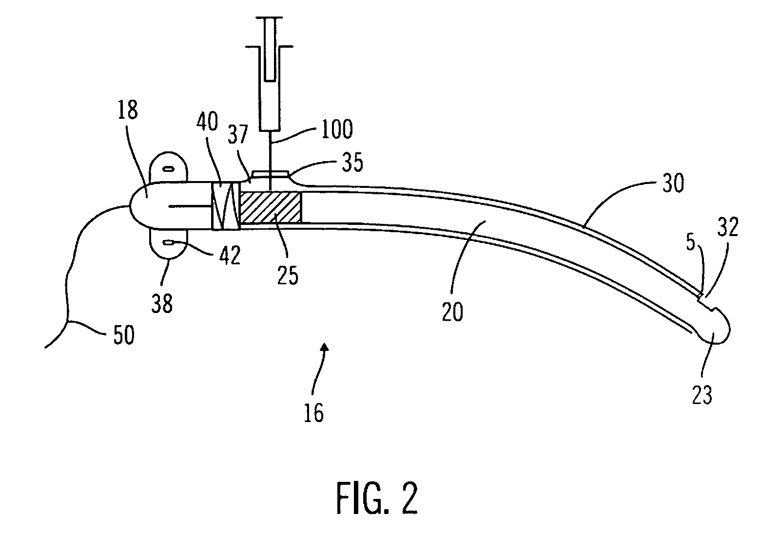 Implantable sensor flush sleeve