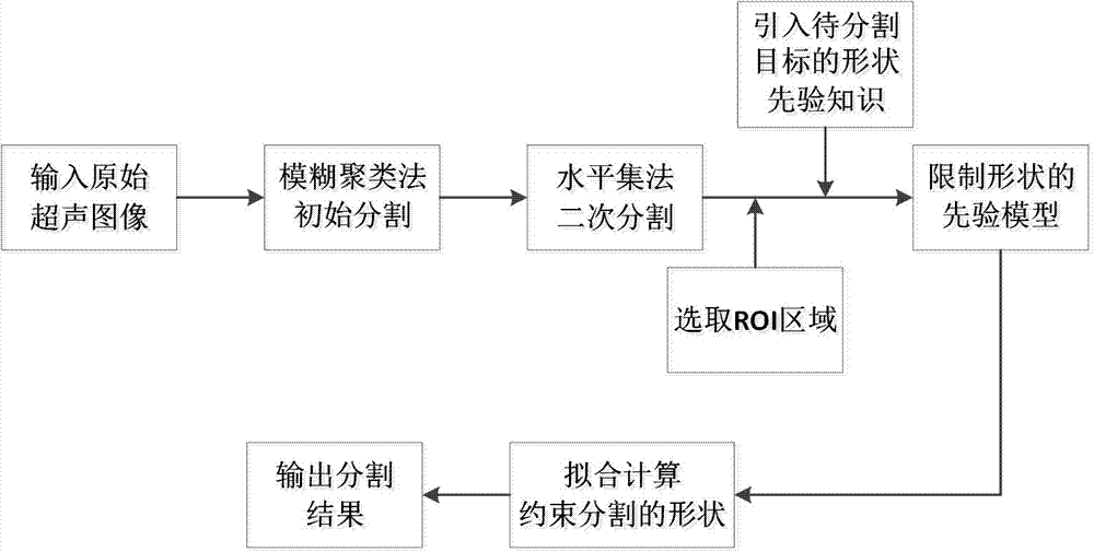 Ultrasonic kinetocardiogram segmentation algorithm