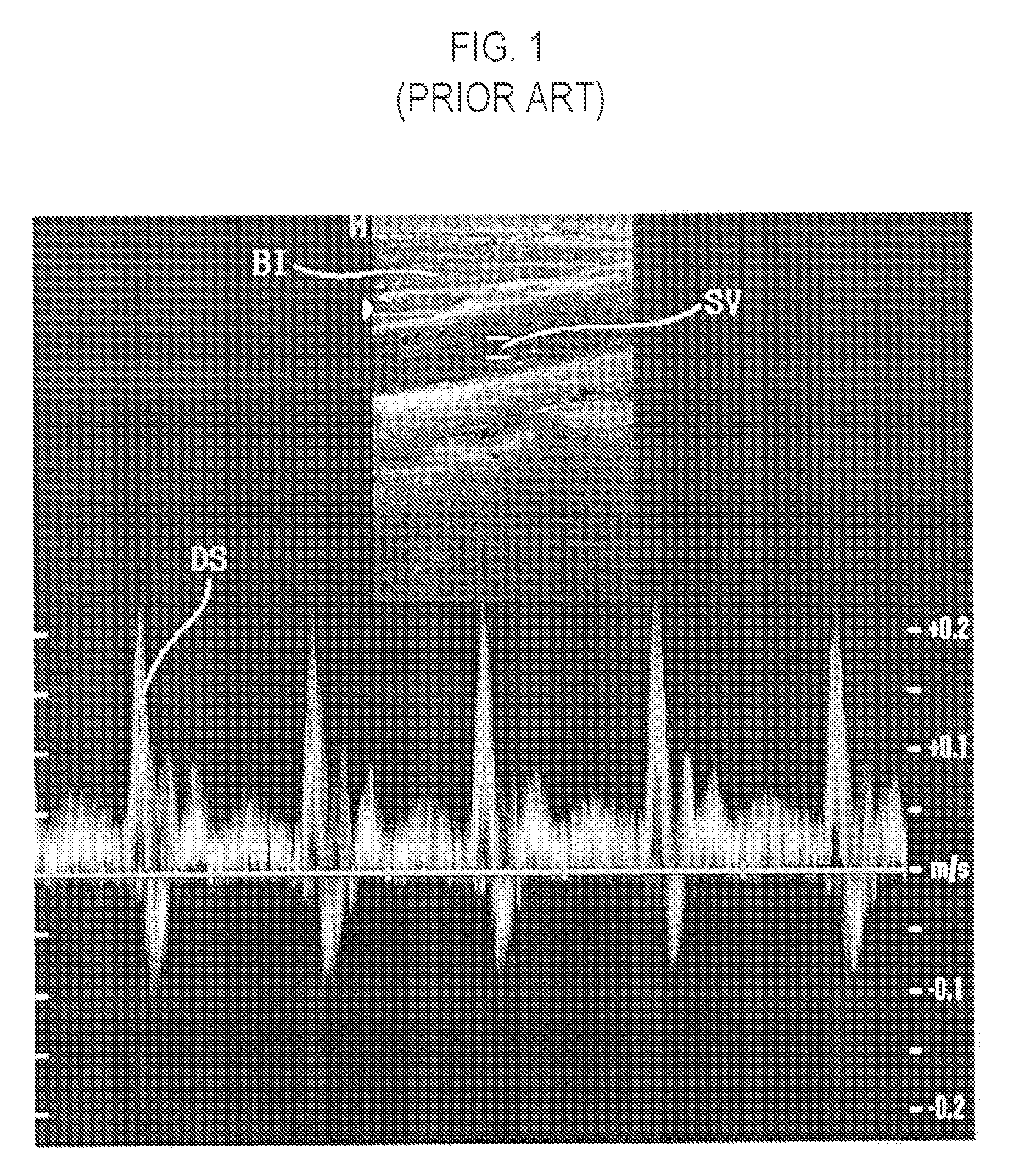 Ultrasound diagnostic system and method for displaying a doppler spectrum image