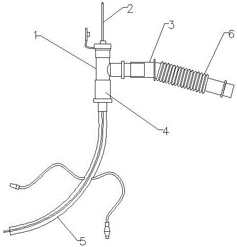 Bronchoscope assistant connection device