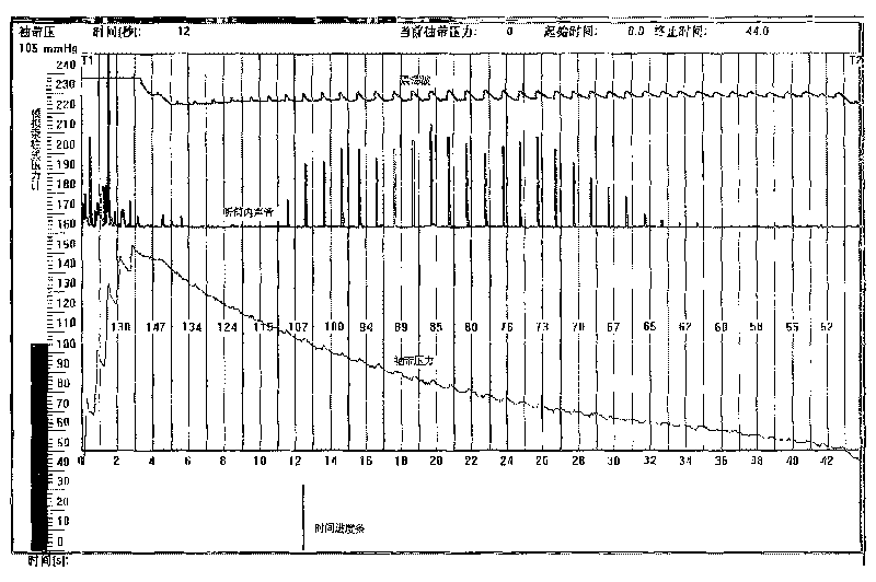 Korotkoff's sounds visual evaluating method and apparatus for electric sphygmomanometer accuracy