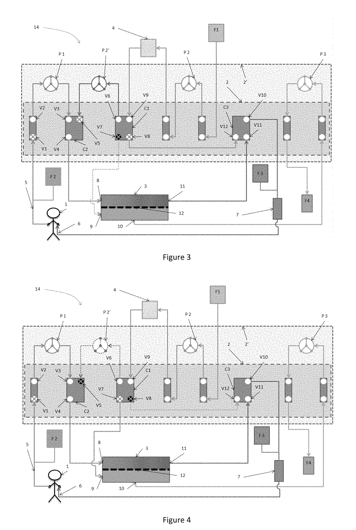 Device for extracorporeal blood treatment