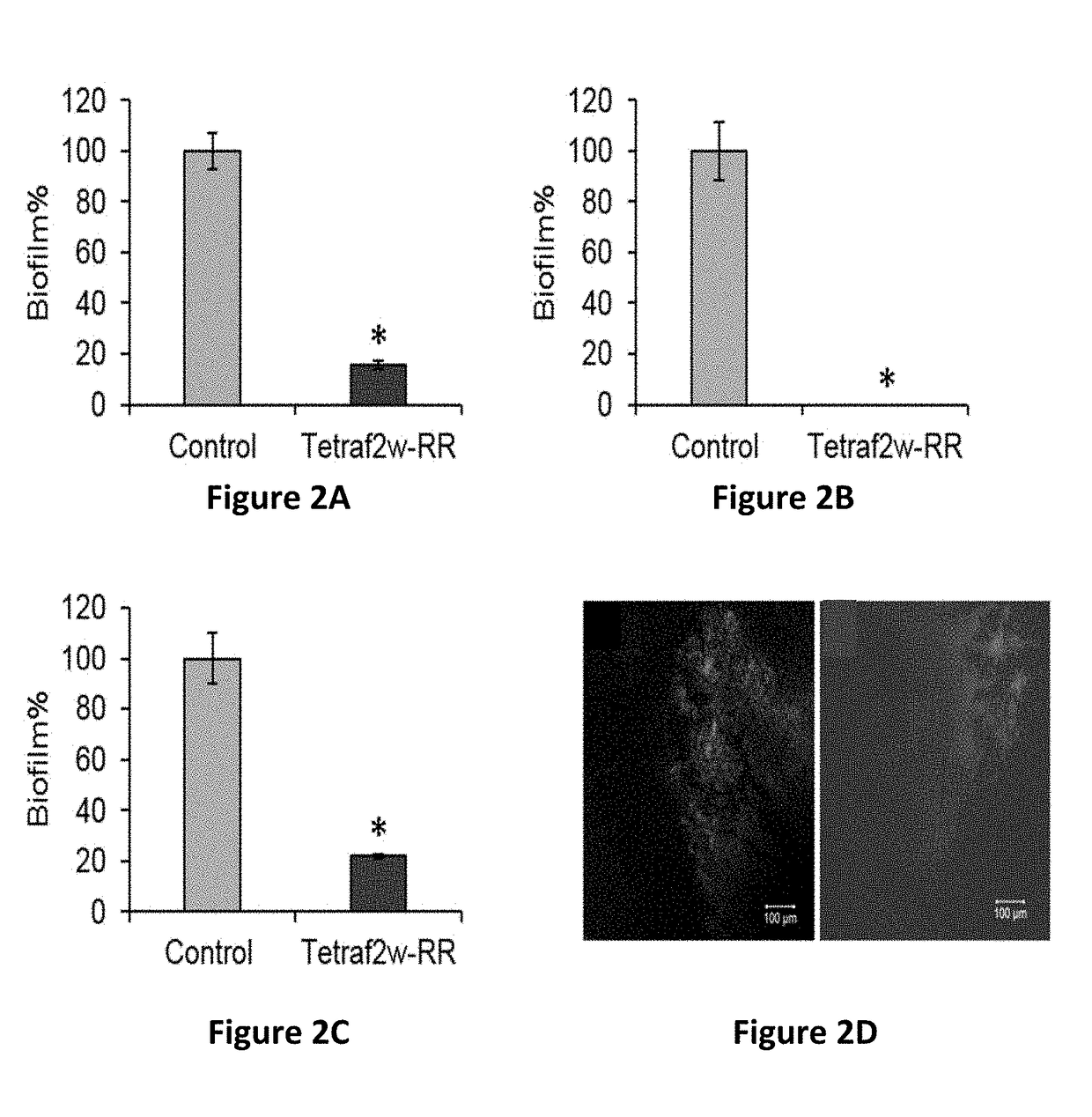 Anti-Microbial Peptides and Coatings