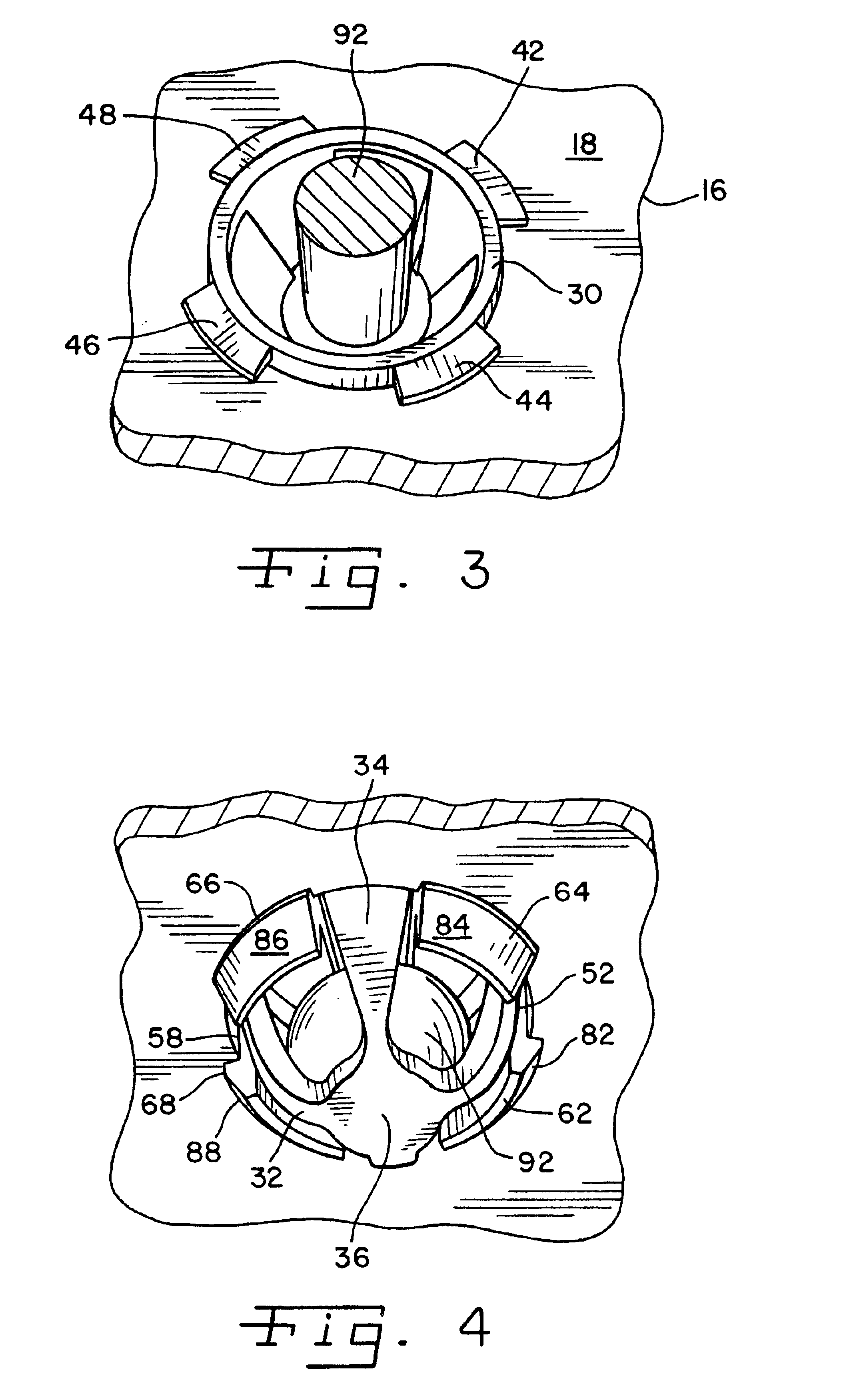 Push-in ball socket