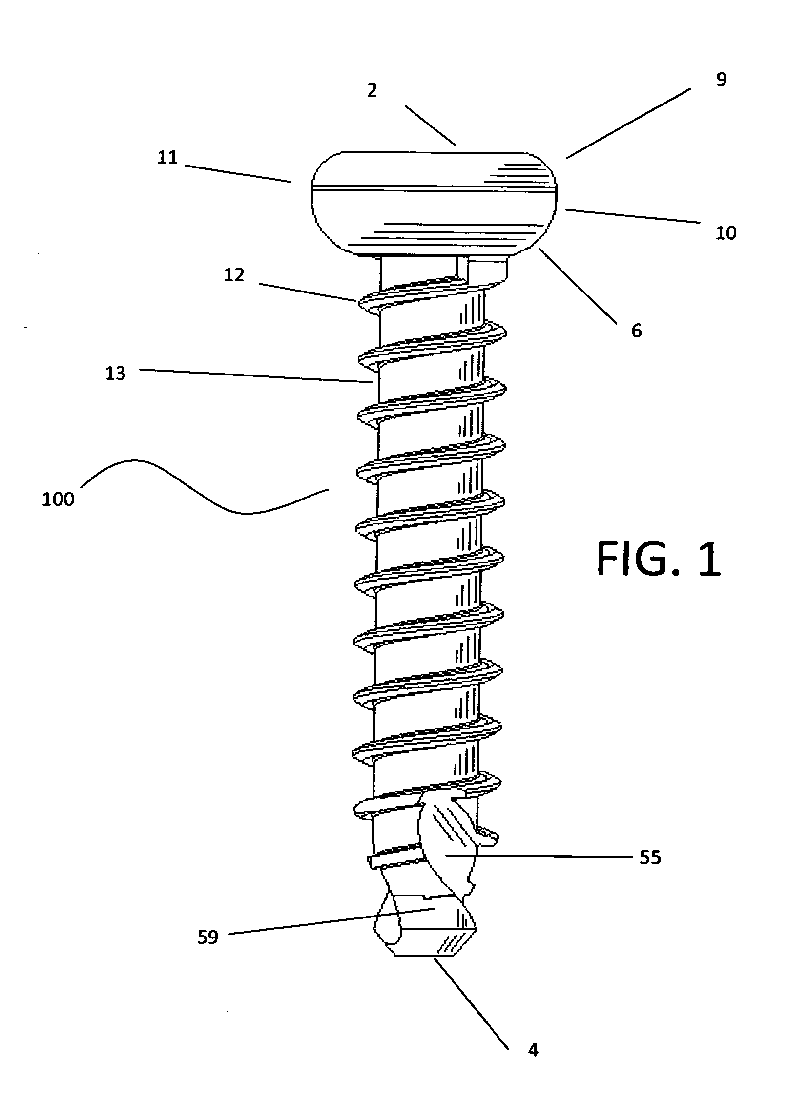 Orthopedic fastener method